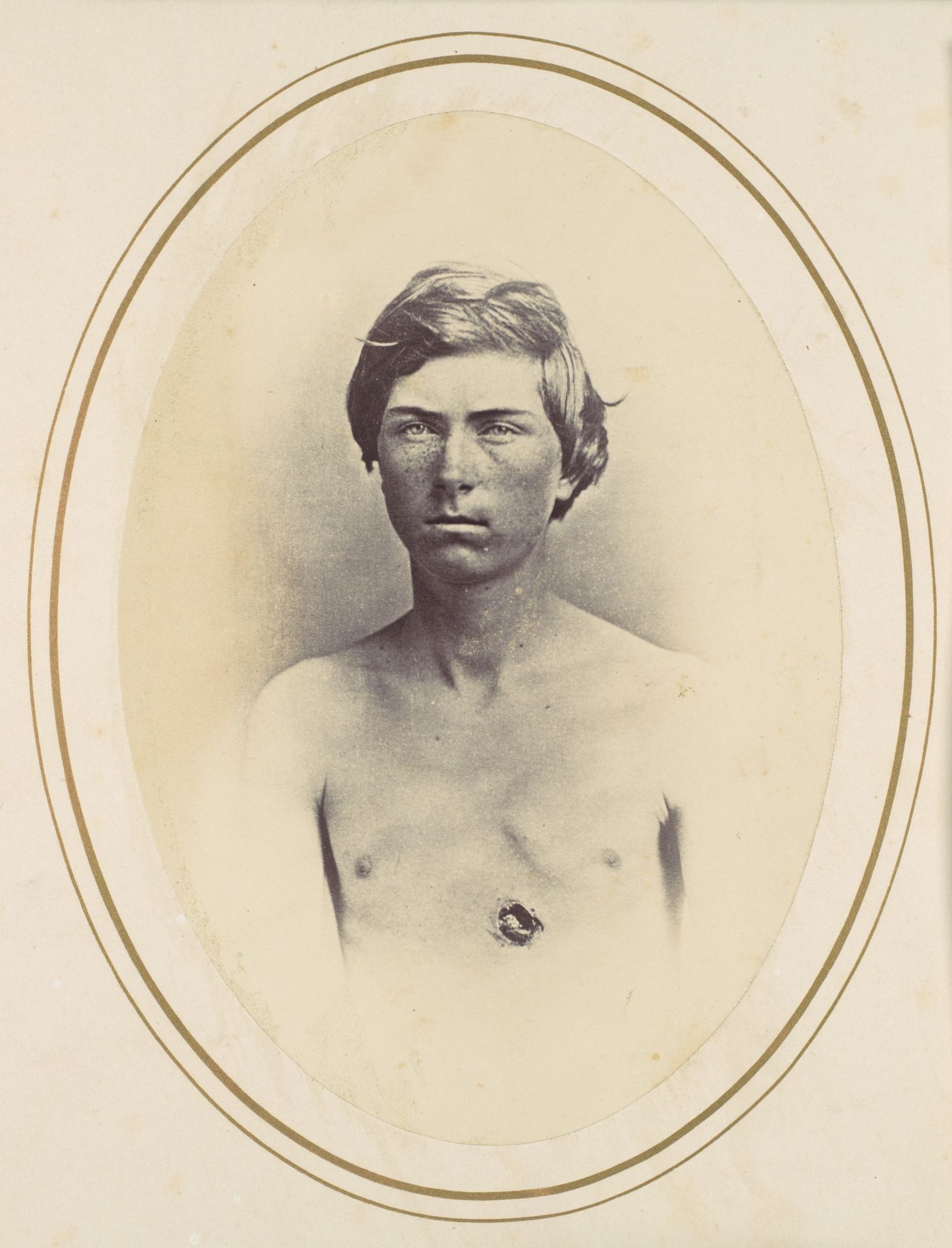 Frederick A. Bentley by Reed Brockway Bontecou
