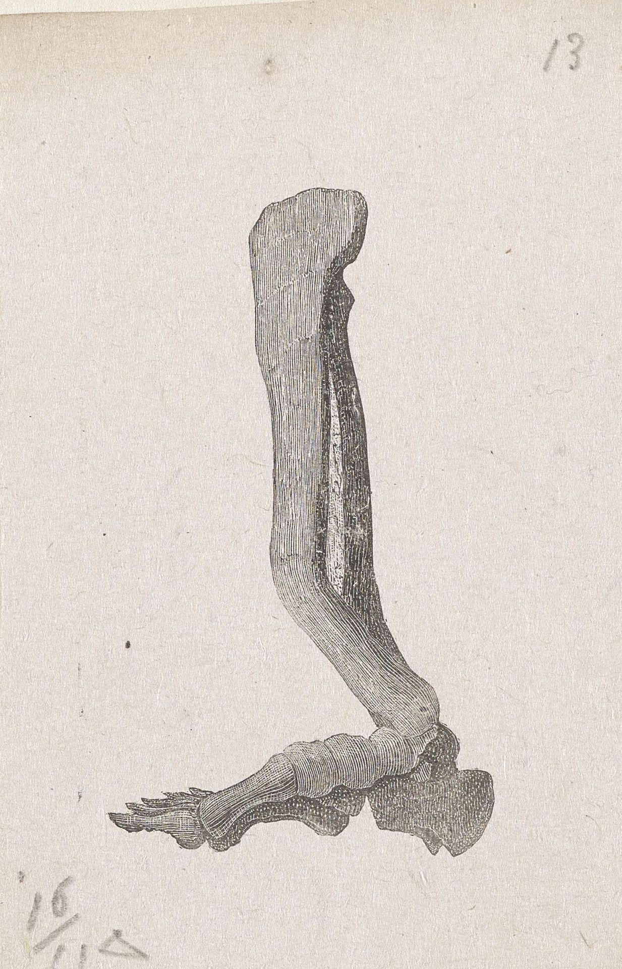 Menselijk bot met een afwijking by Isaac Weissenbruch