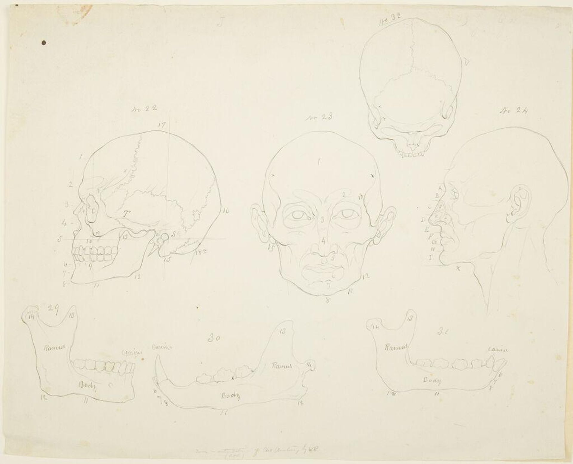 Human Heads, Skulls, and Canine Jaws, for "Art Anatomy" by William Rimmer