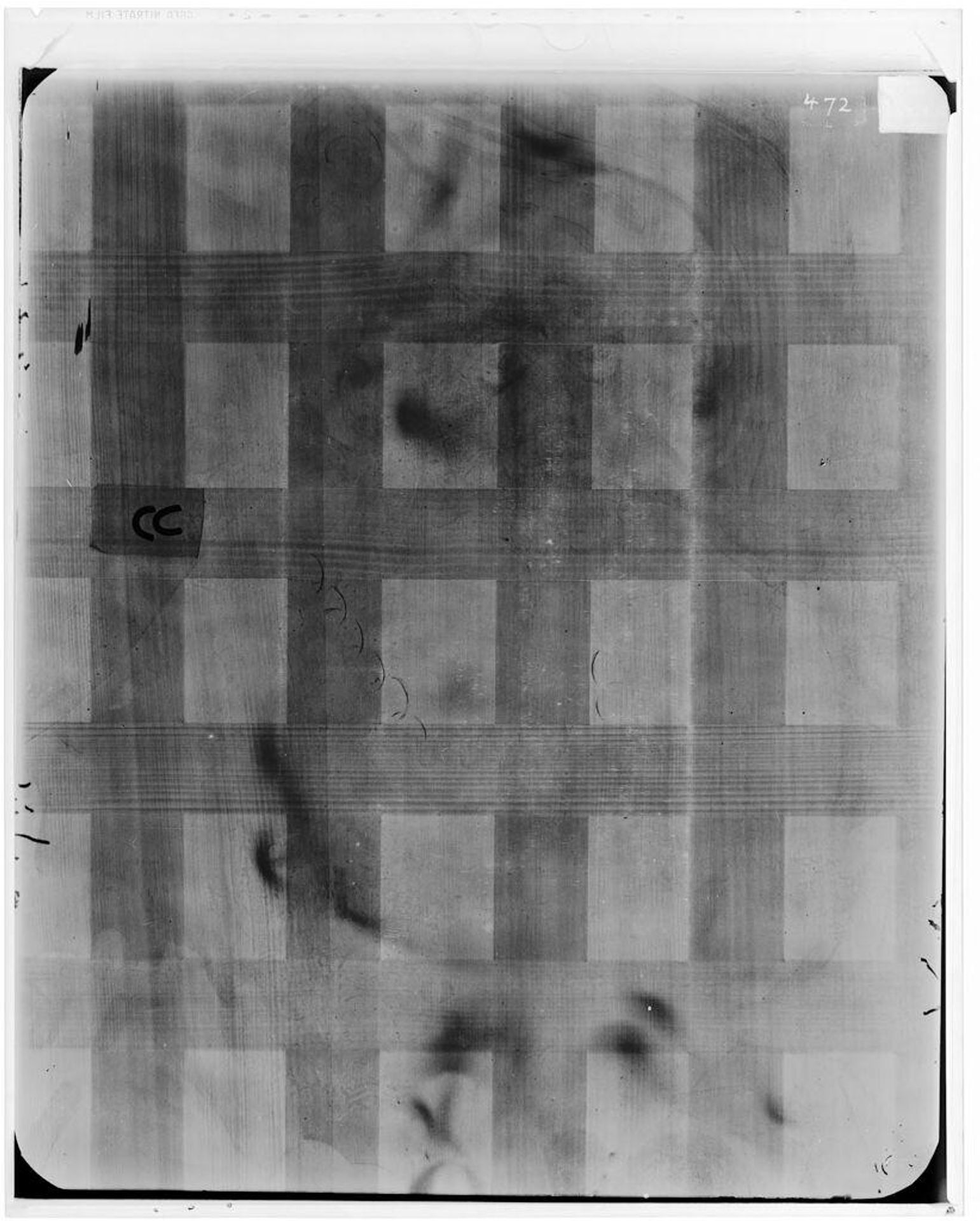 X-radiograph(s) of "Portrait of a Man" by Artist of original: Lucas Cranach the Elder