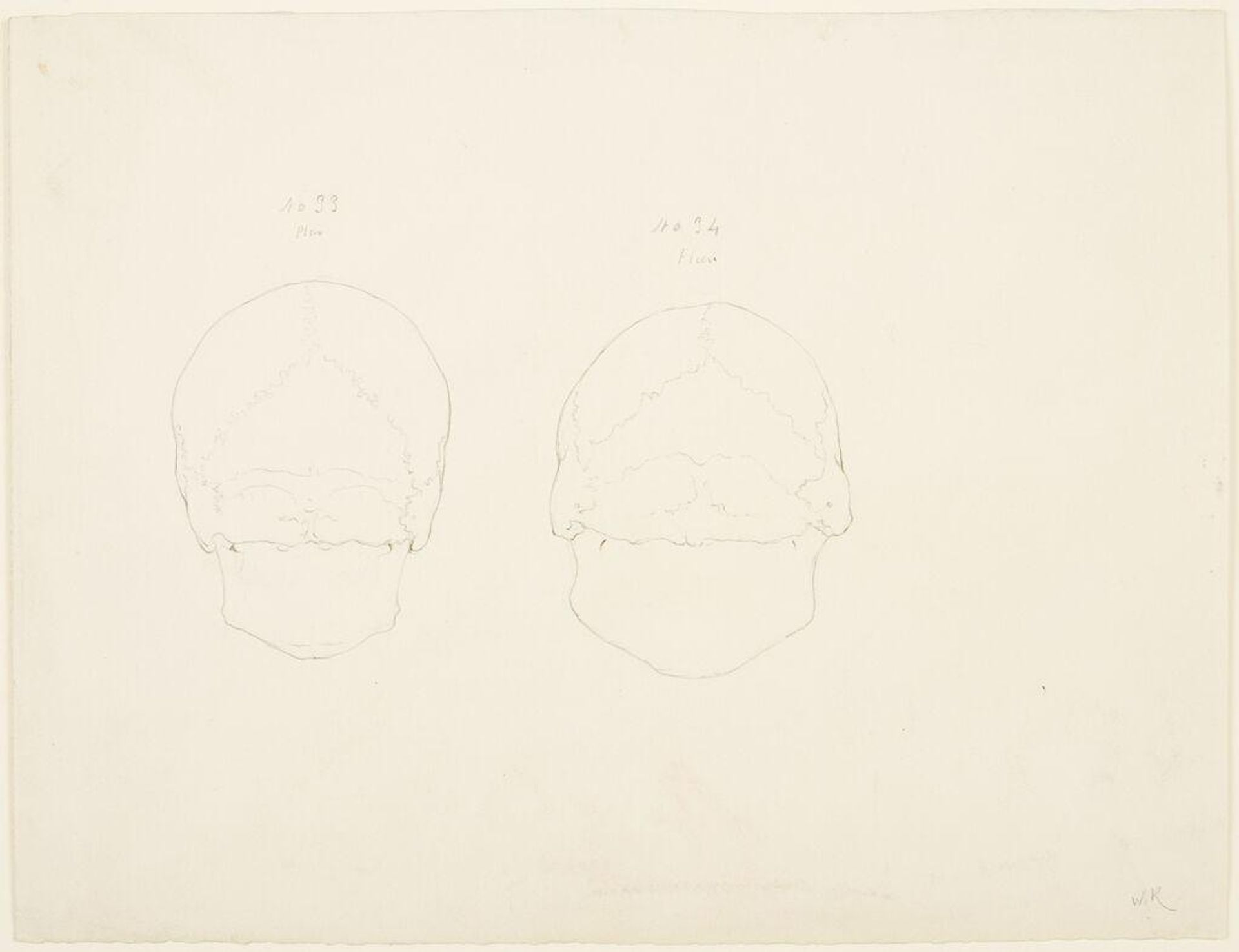 Human Skulls, for "Art Anatomy" by William Rimmer