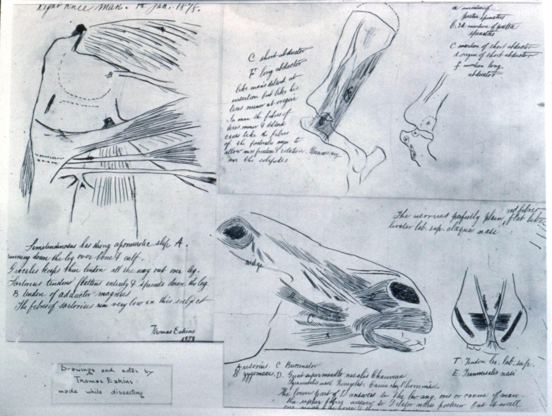 Anatomical studies by Thomas Eakins