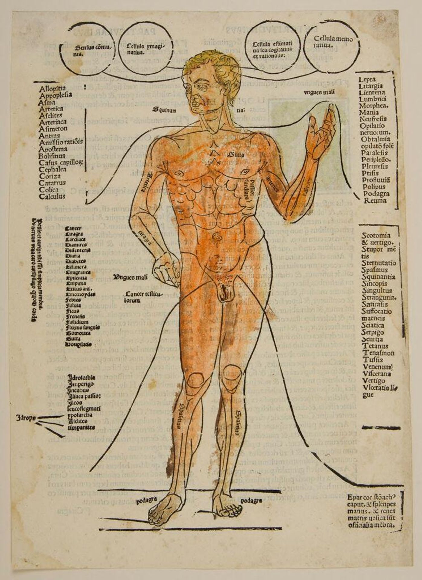 Nude with marginal list of various diseases by Anonymous