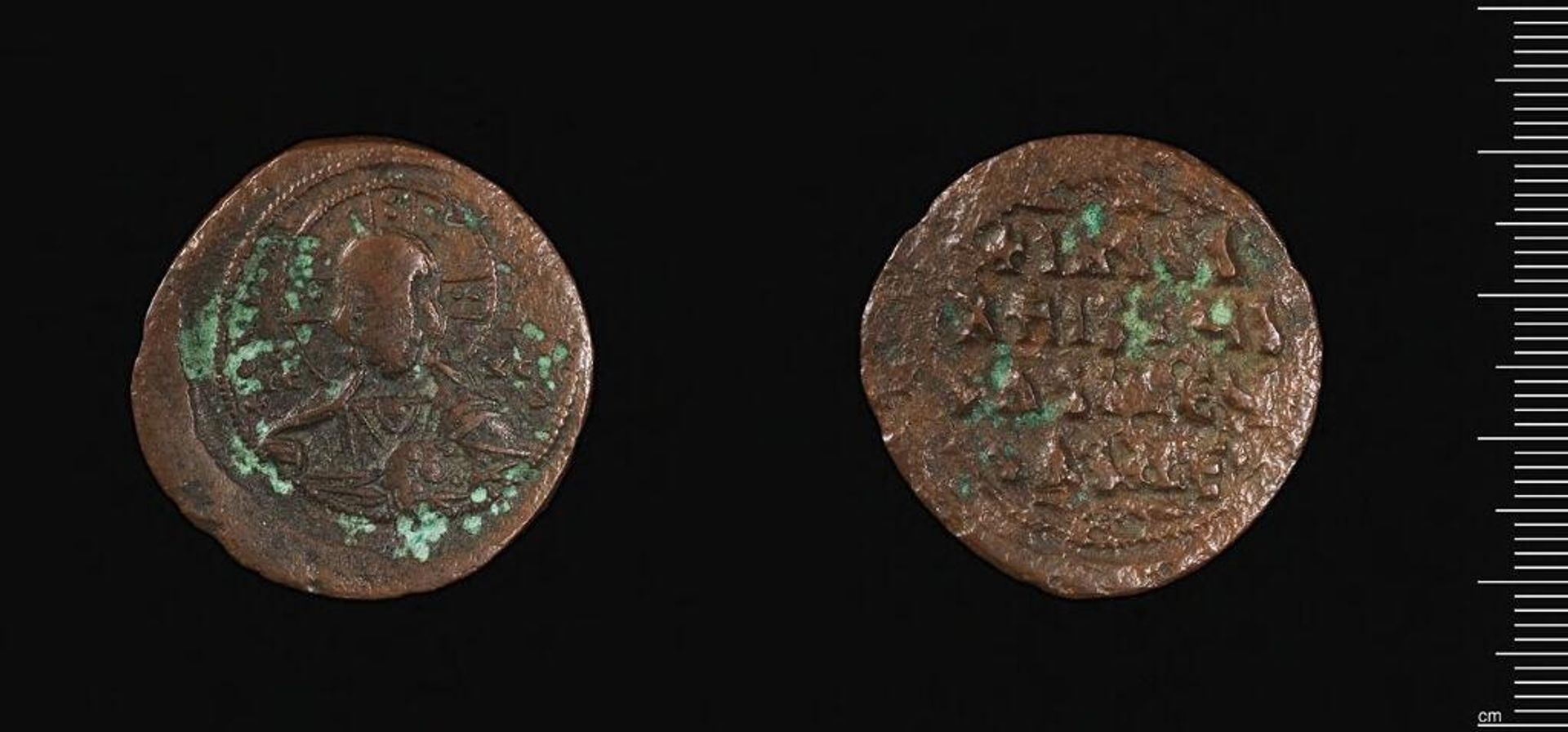 Anonymous Follis by Anonymous