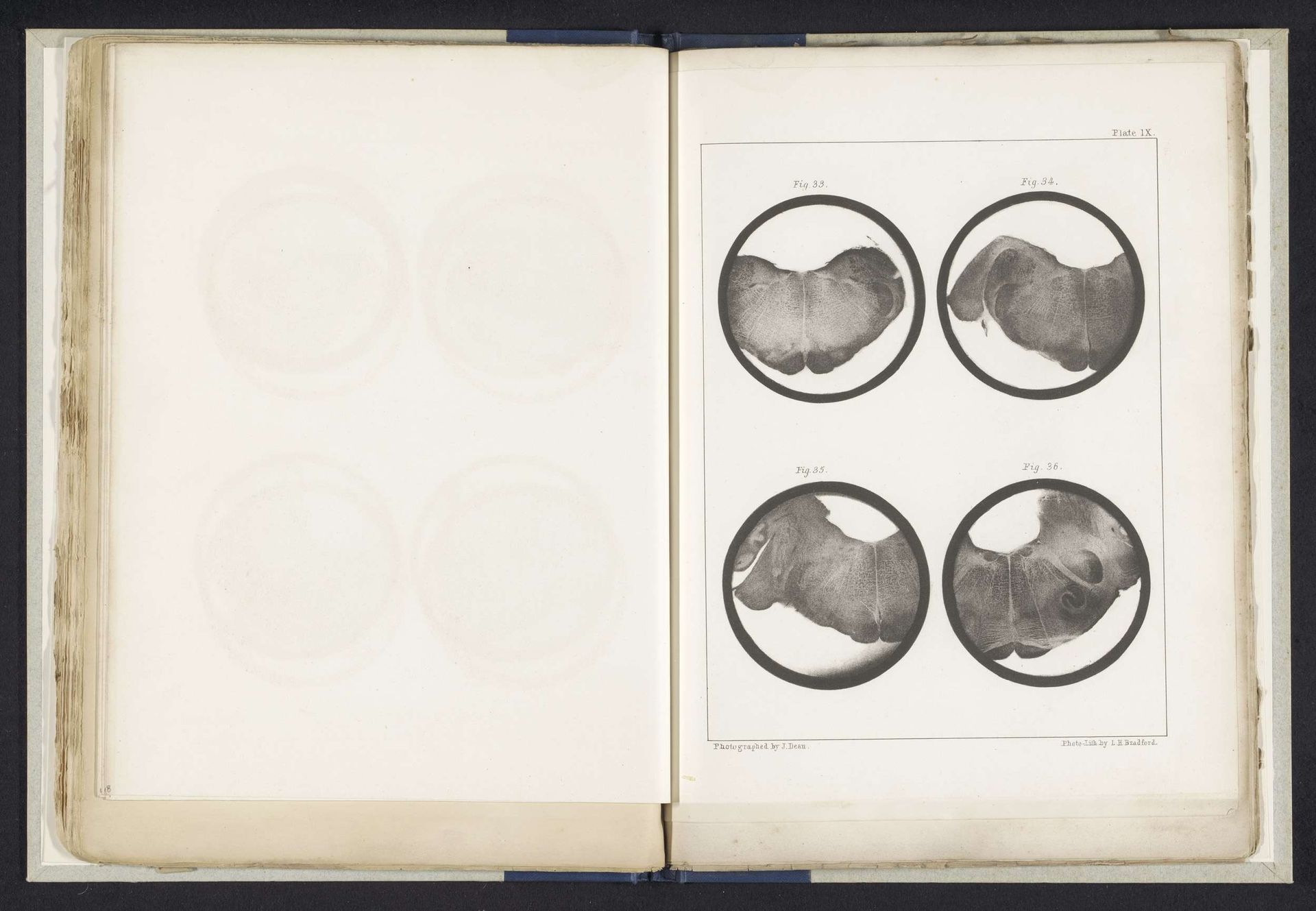 Vier details van een medulla oblongata van een mens by John Dean