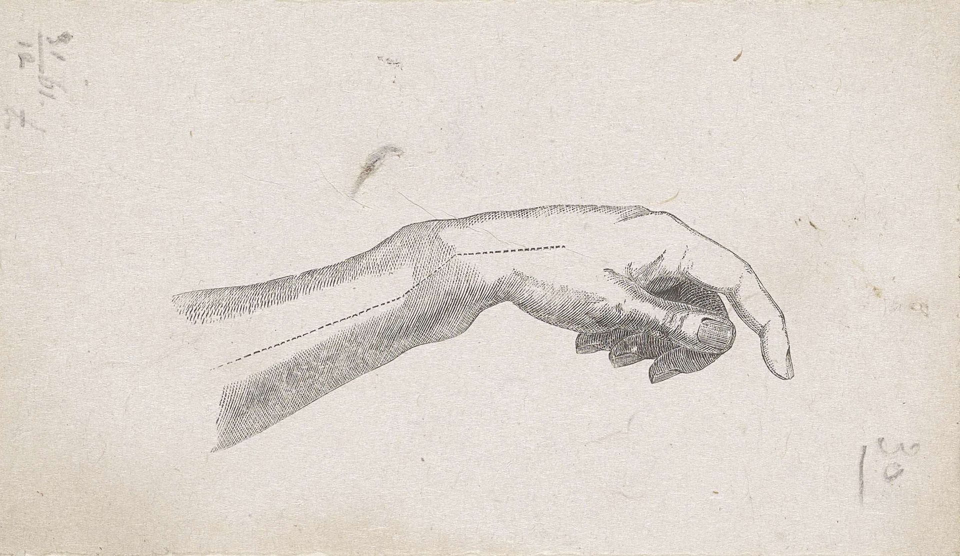 Menselijke pols met een breuk in het bot by Isaac Weissenbruch