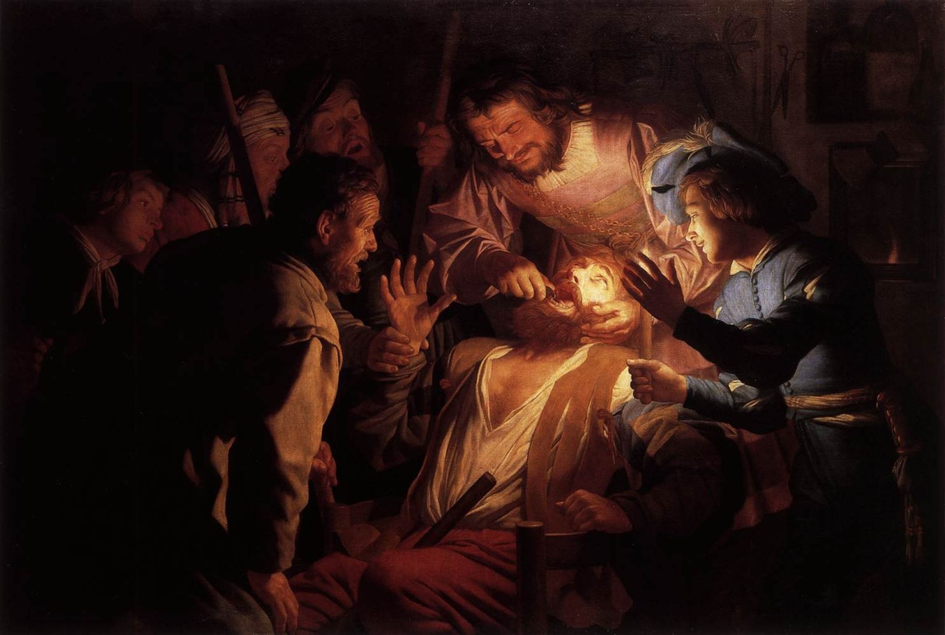The Dentist by Gerard van Honthorst
