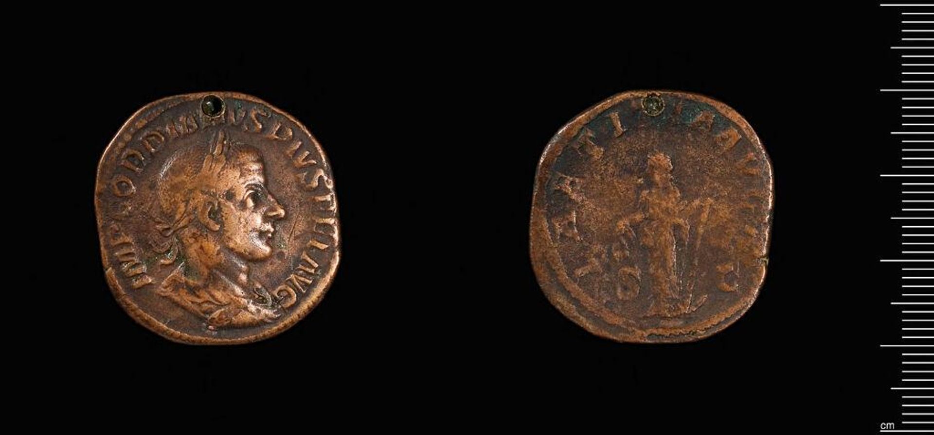 Sestertius of Gordian III, pierced by Gordian III