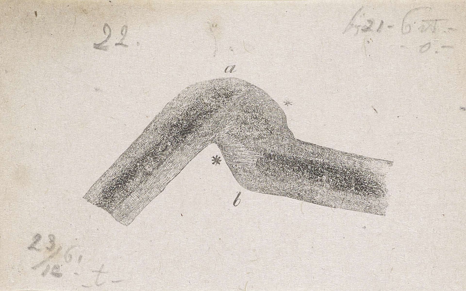 Onderdeel van het menselijk lichaam met een afwijking by Isaac Weissenbruch