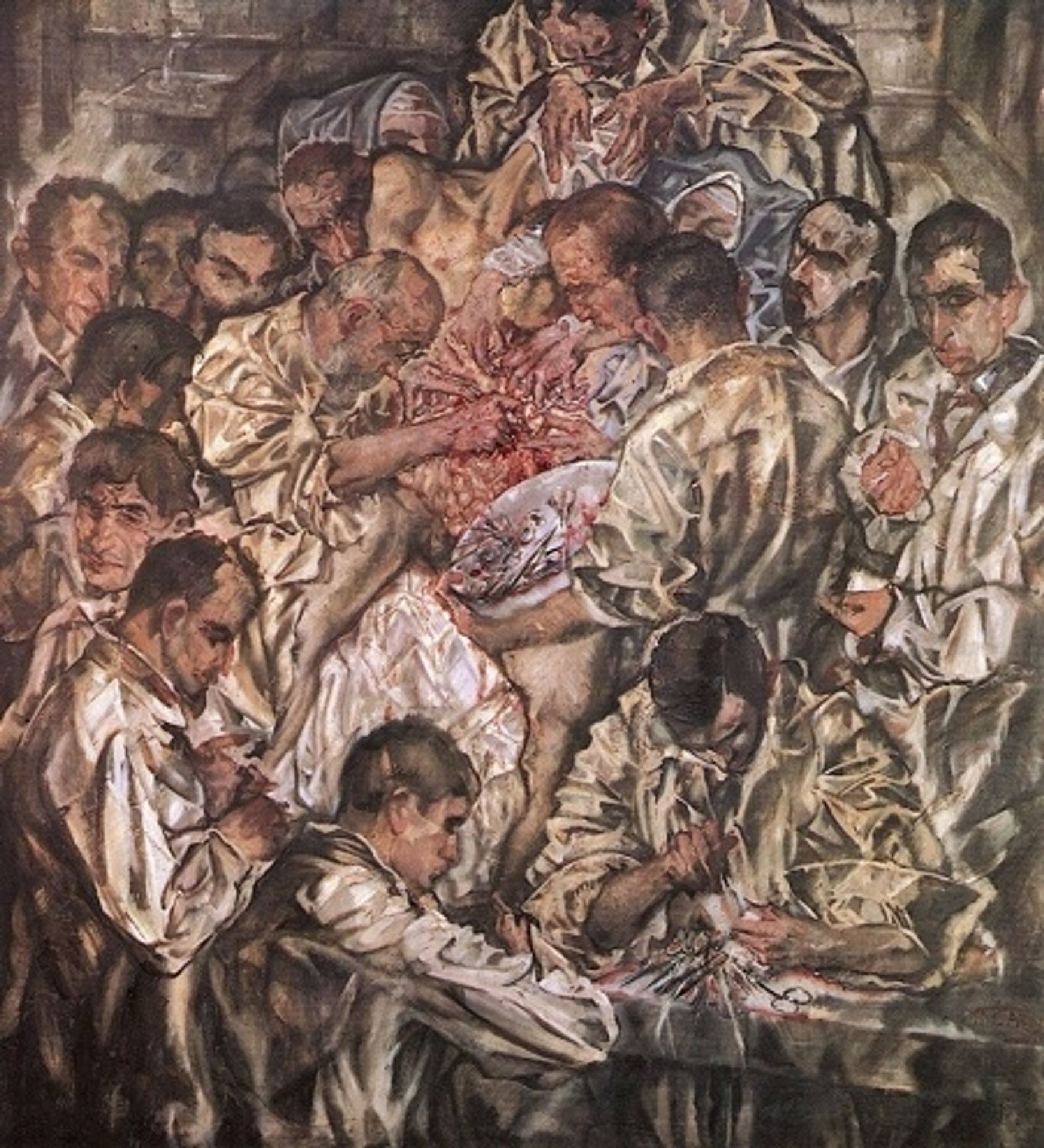 Operation by Max Oppenheimer