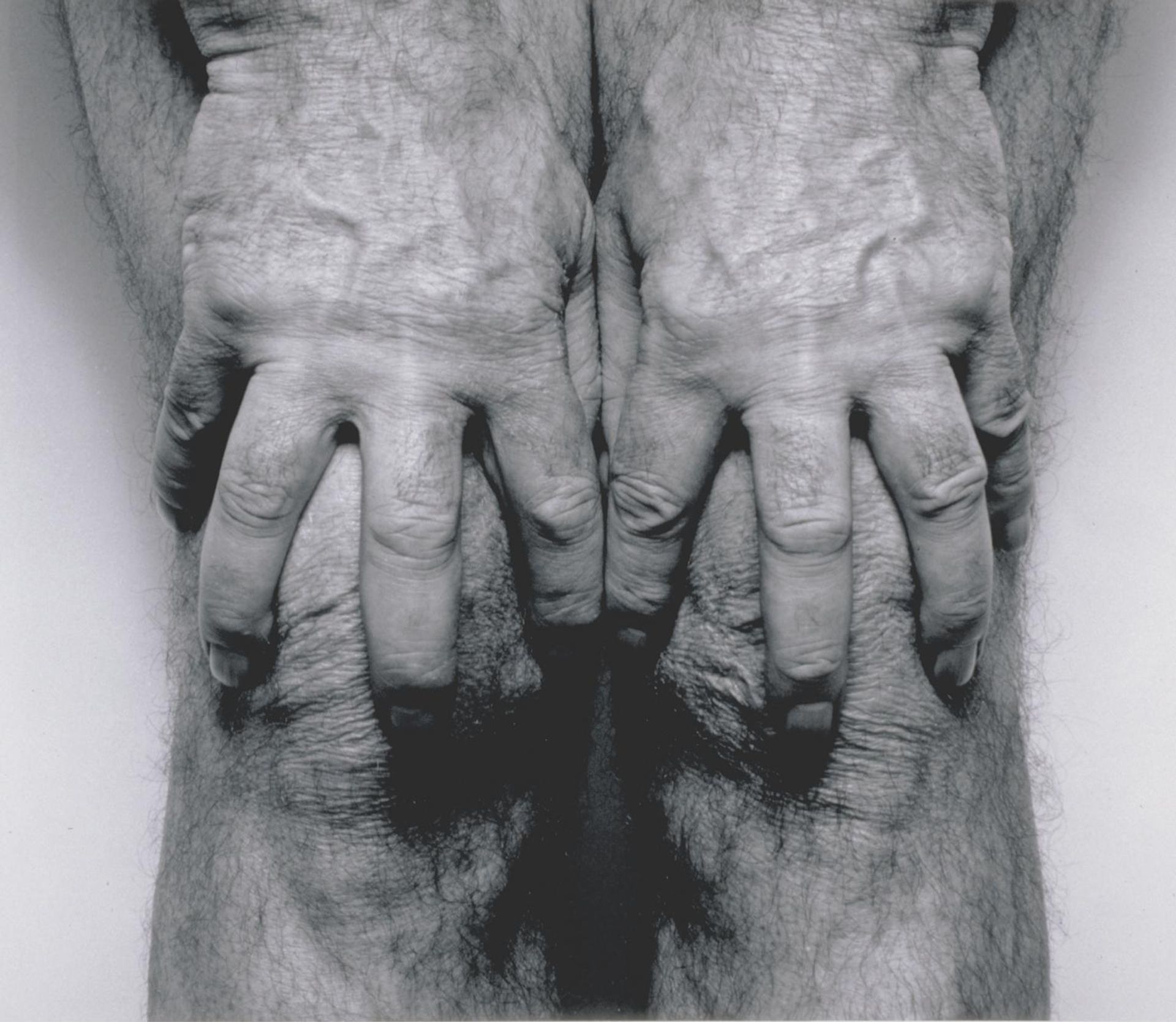 Self-Portrait (Hands Spread on Knees) by  John Coplans