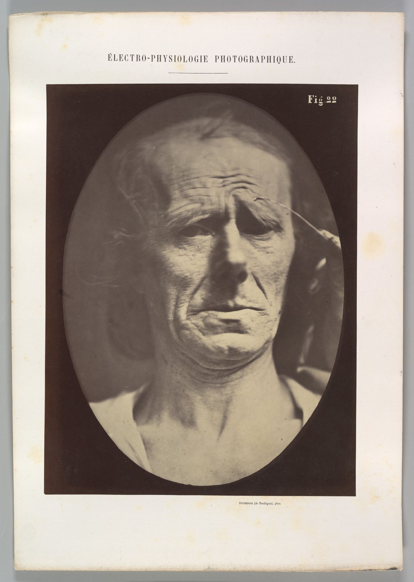 Figure 22: No painful expression by Guillaume Benjamin Amand Duchenne