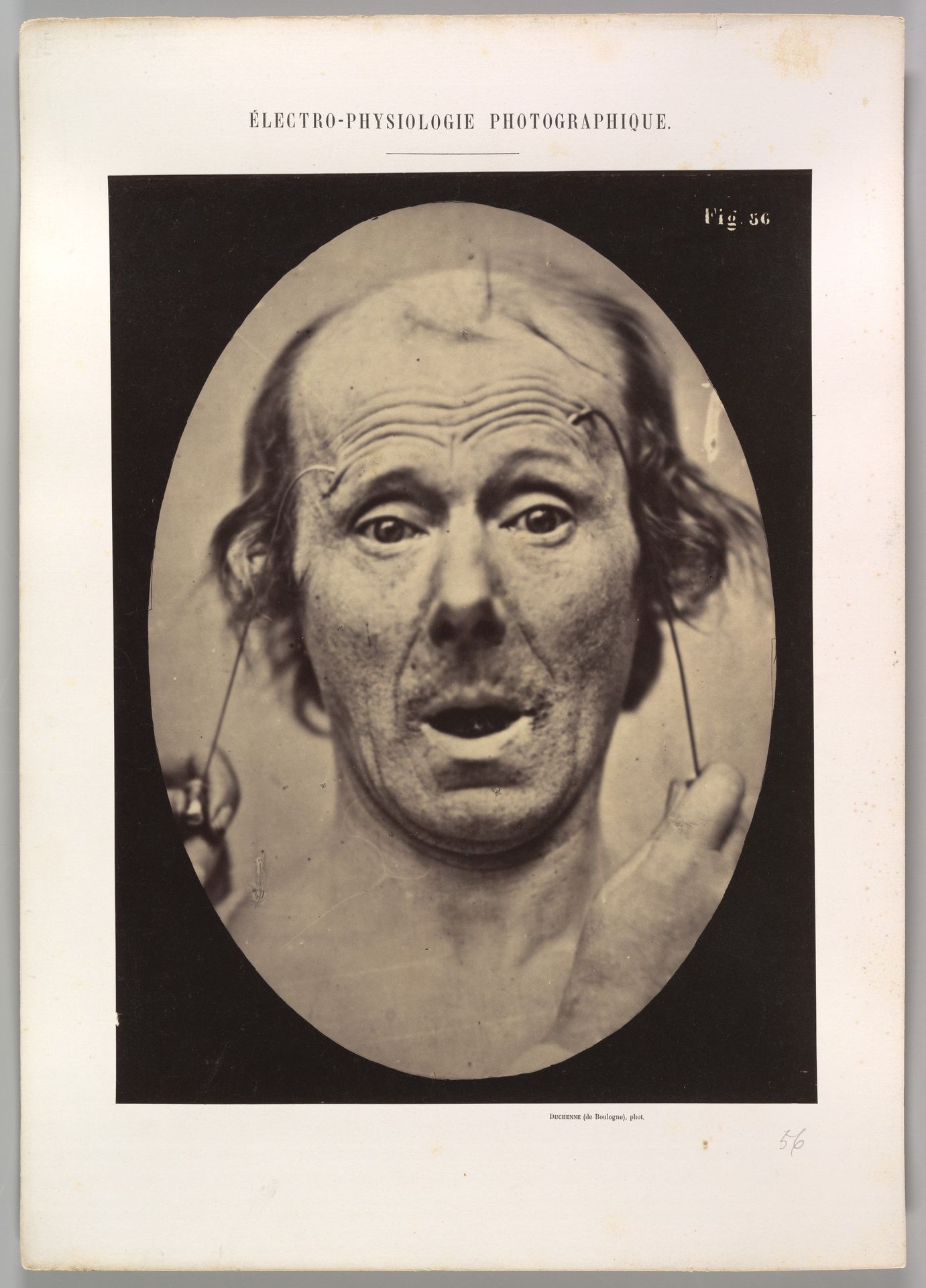 Figure 56: Surprise by Guillaume Benjamin Amand Duchenne