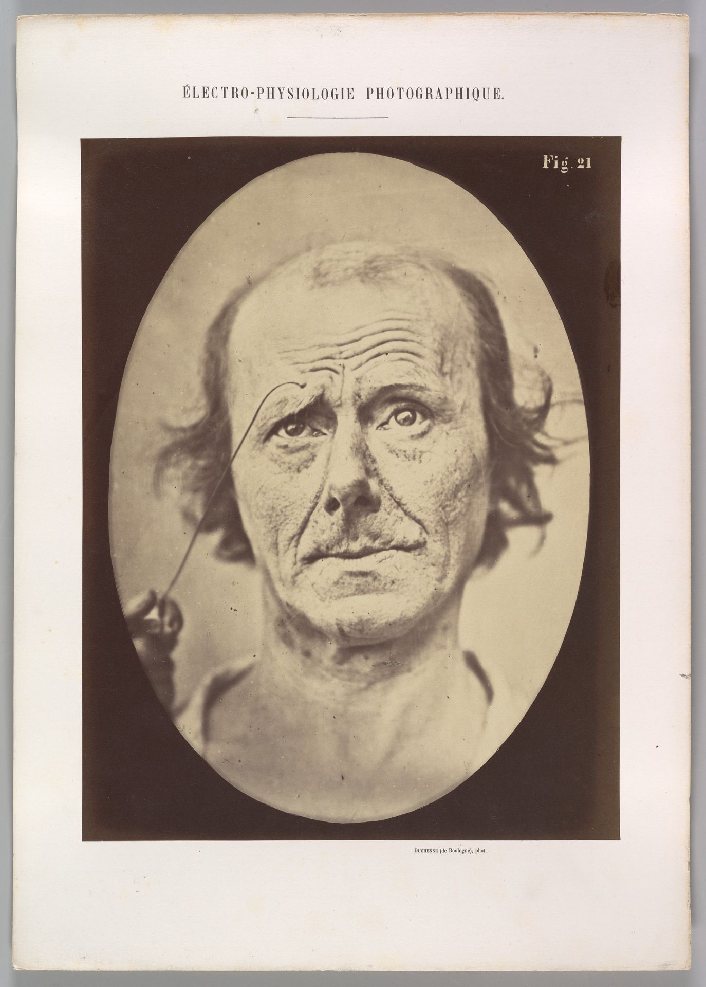 Figure 21: Painful recollection and recollection or calling something to mind by Guillaume Benjamin Amand Duchenne