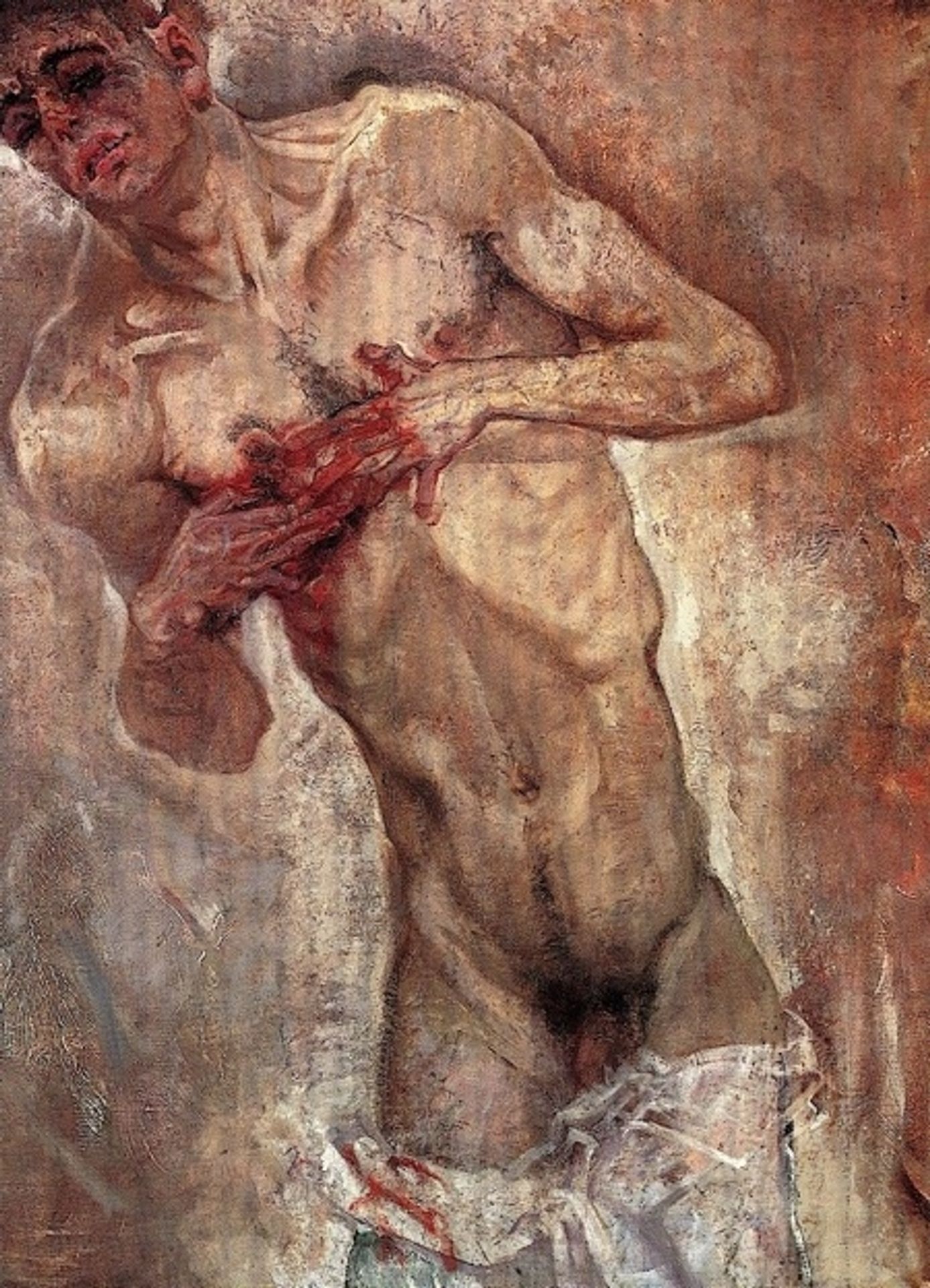 Bleeding by Max Oppenheimer