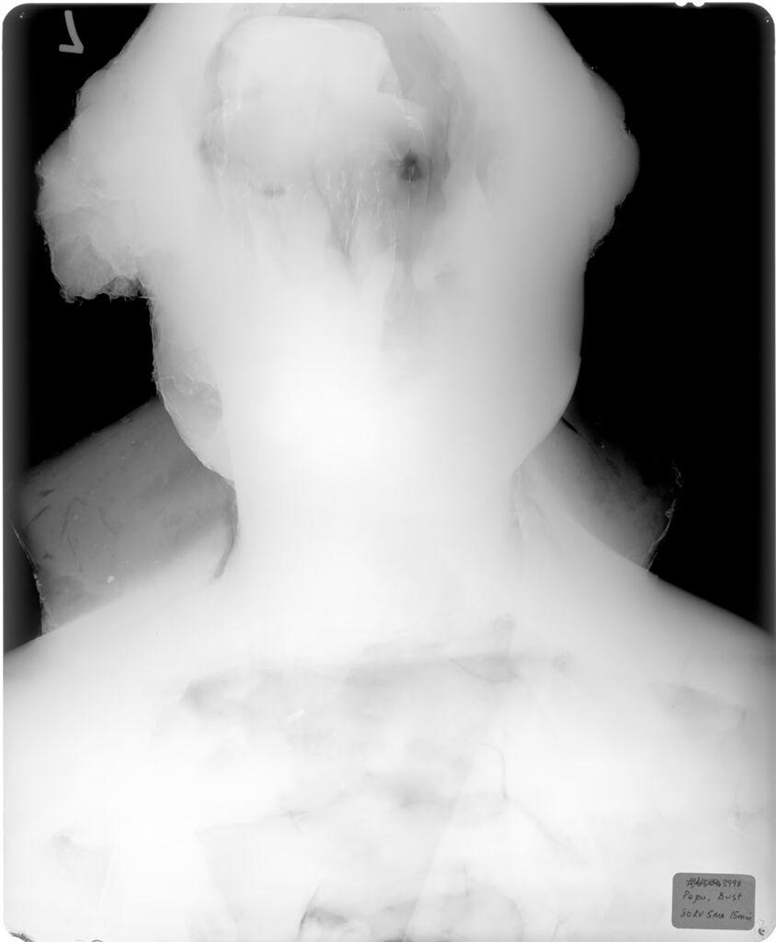 X-radiograph(s) of "Bust of Corbin de Cordet" by Artist of original: Augustin Pajou