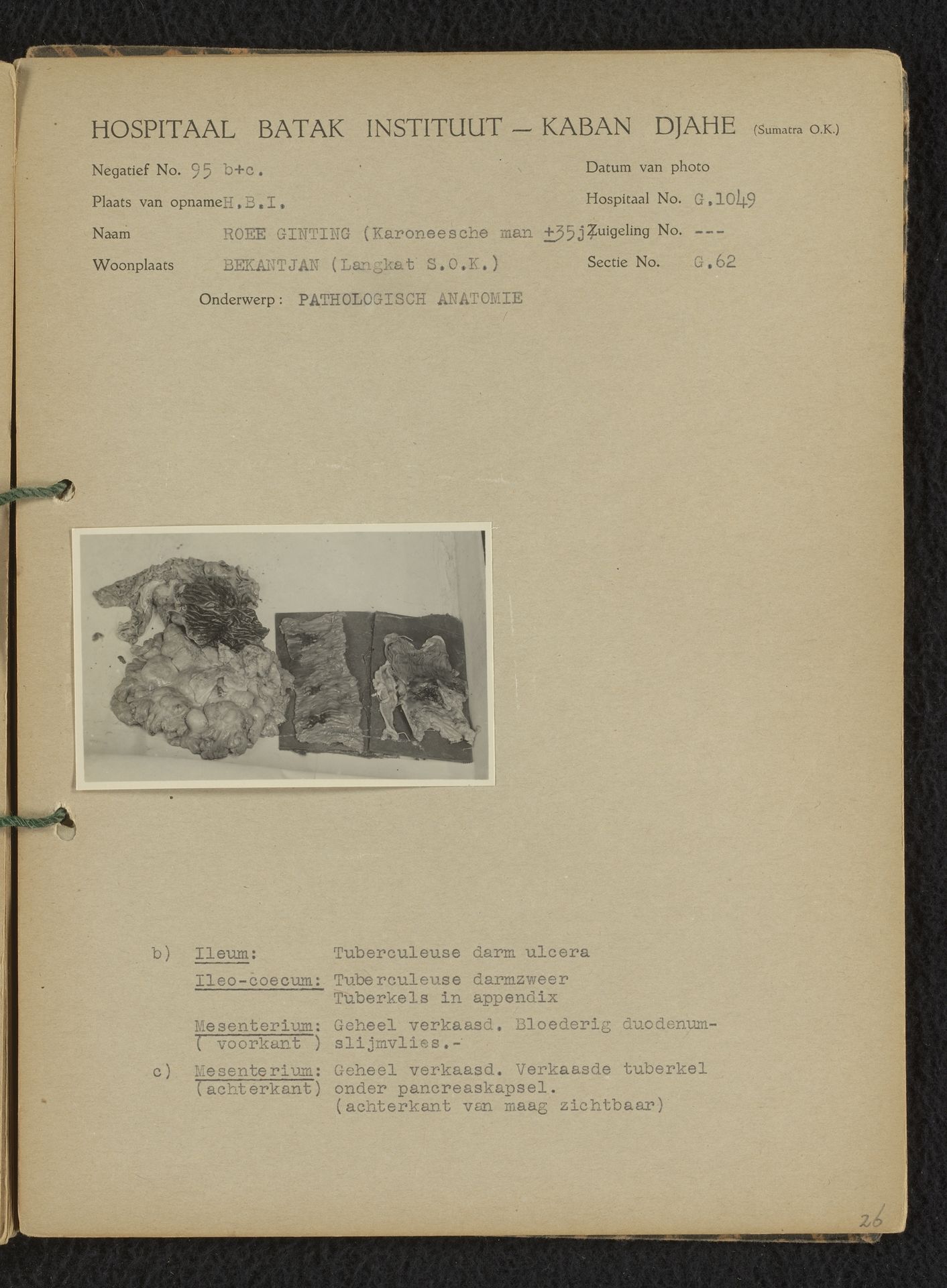 Pathologische anatomie by Hospitaal Batak Instituut
