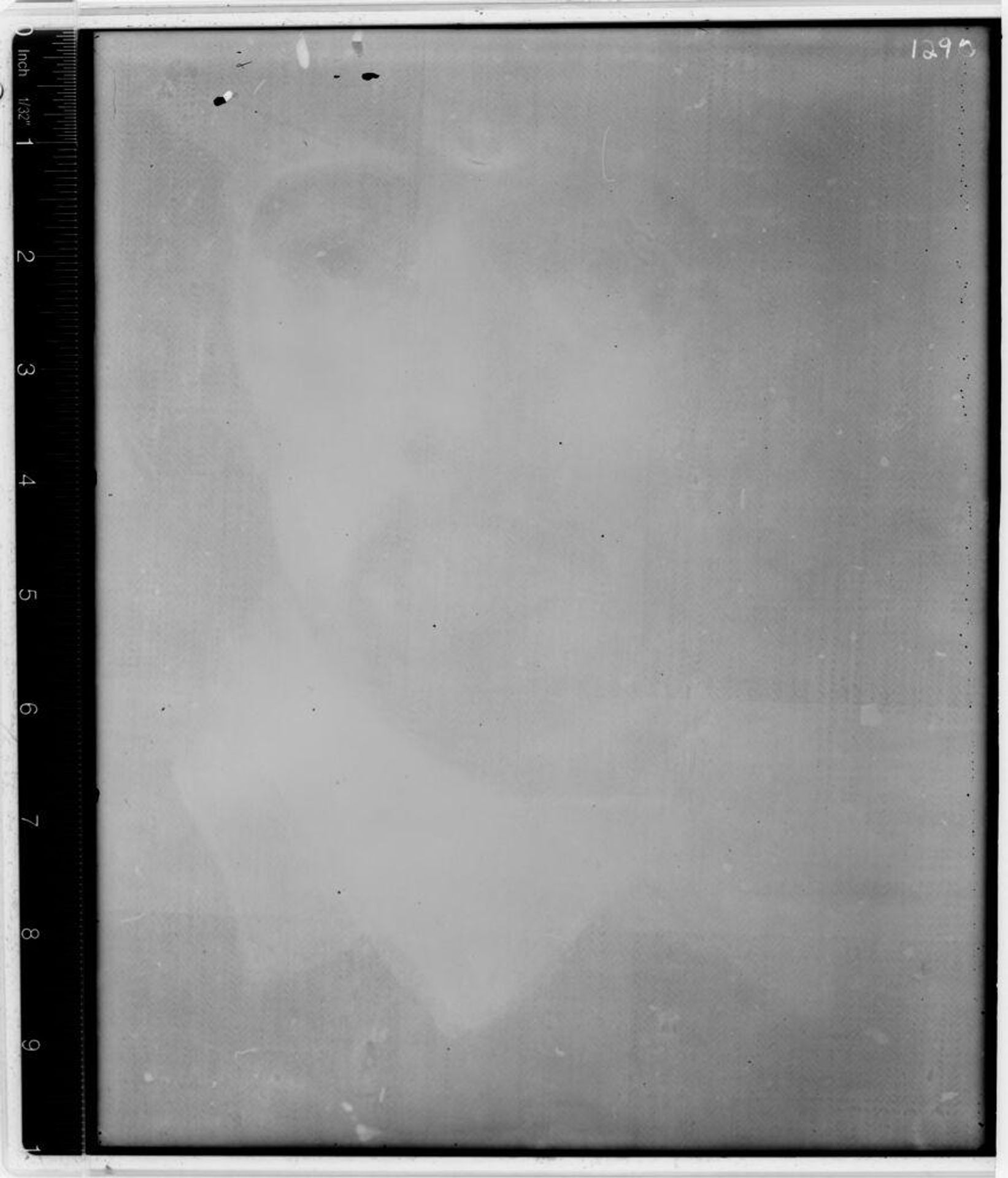 X-radiograph(s) of "Portrait of a Man" by Artist of original: Nicolaes Maes