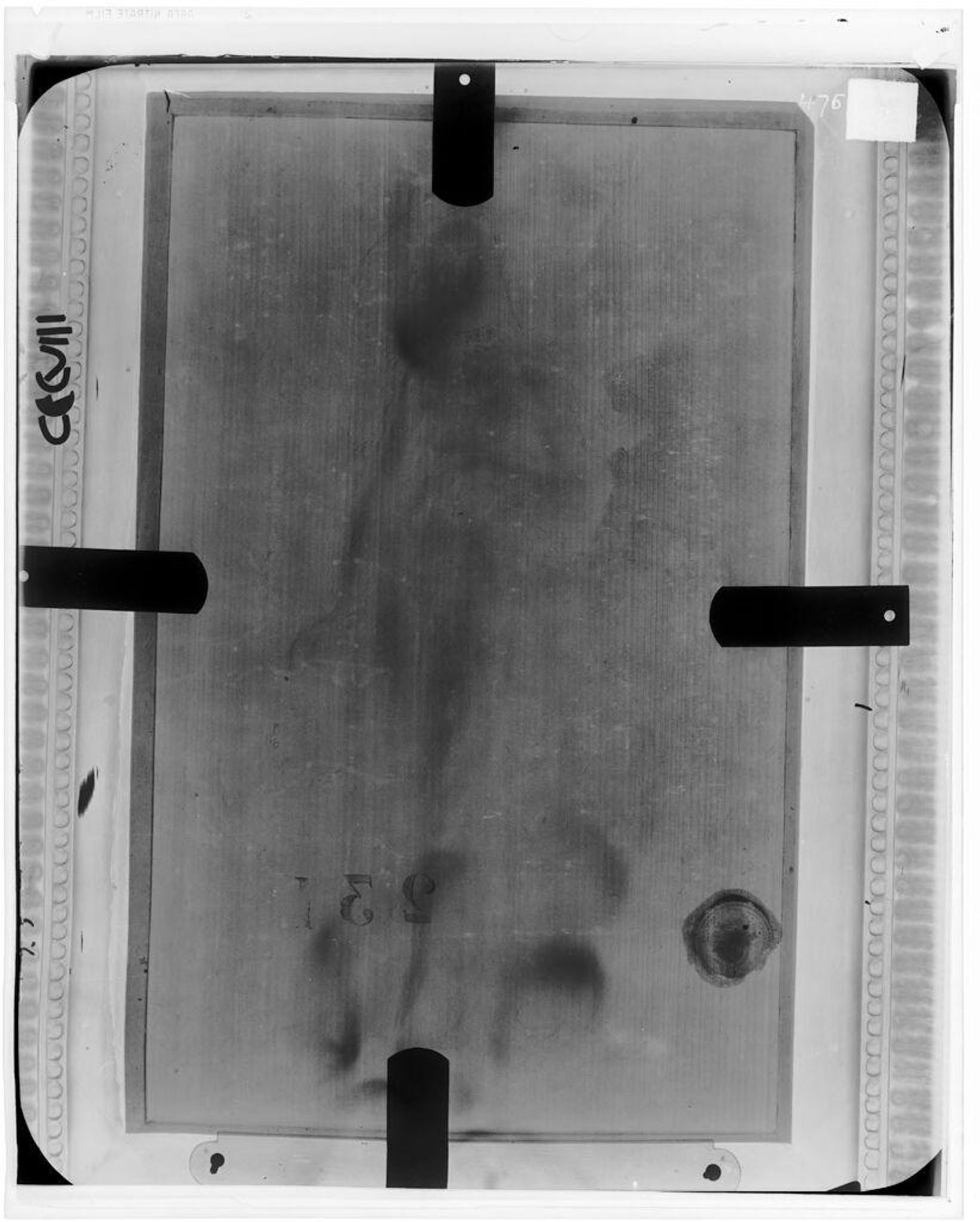X-radiograph(s) of "Venus" by Artist of original: Lucas Cranach the Elder