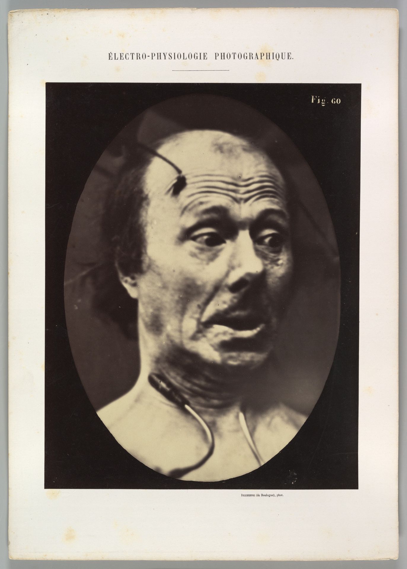 Figure 60: Fright by Guillaume Benjamin Amand Duchenne