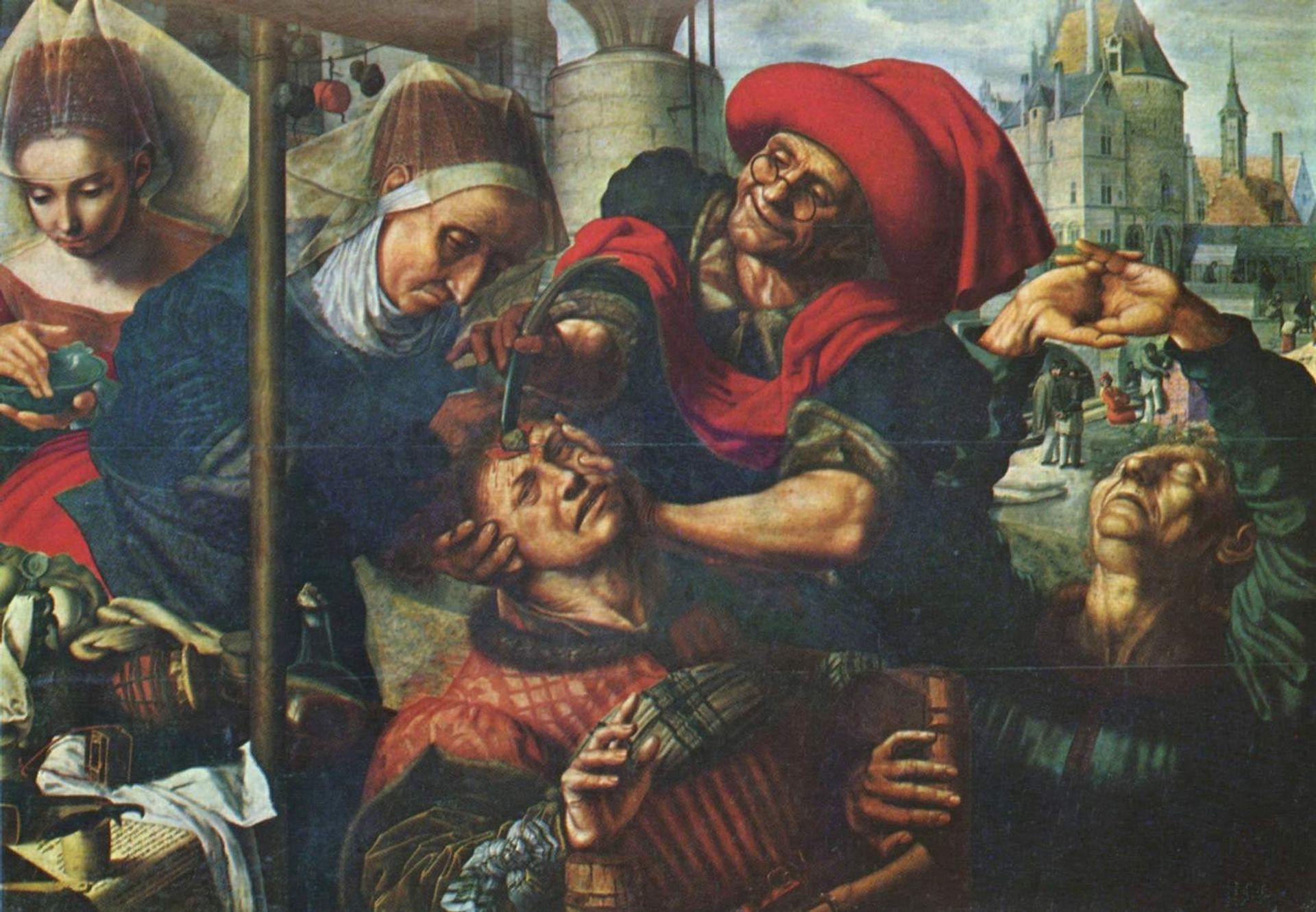 The Surgeon by Jan van Hemessen