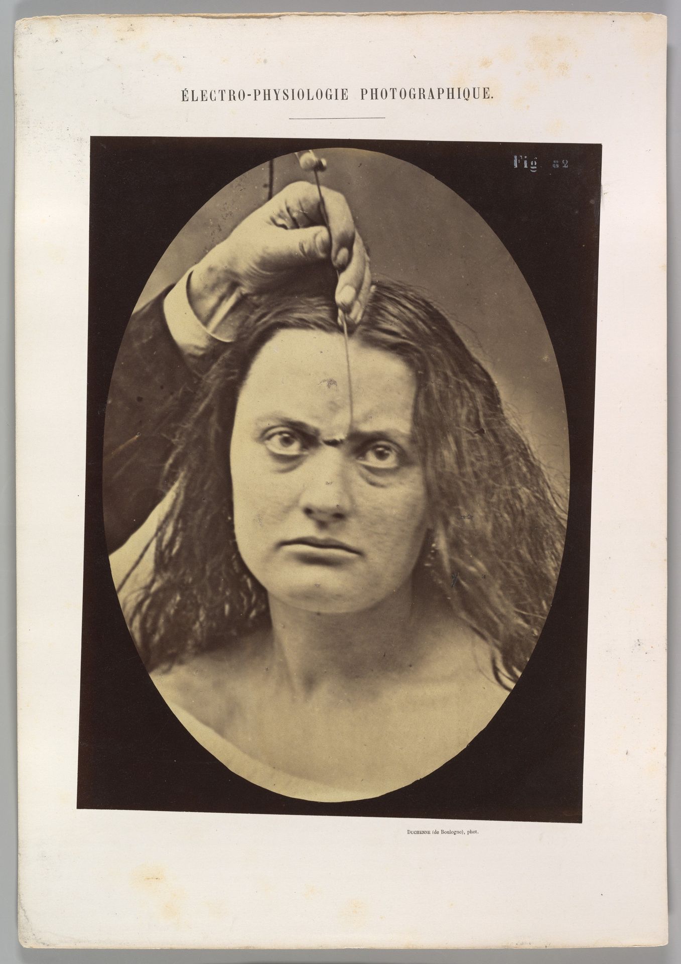 Figure 82: Lady Macbeth, strong expression of cruelty by Guillaume Benjamin Amand Duchenne