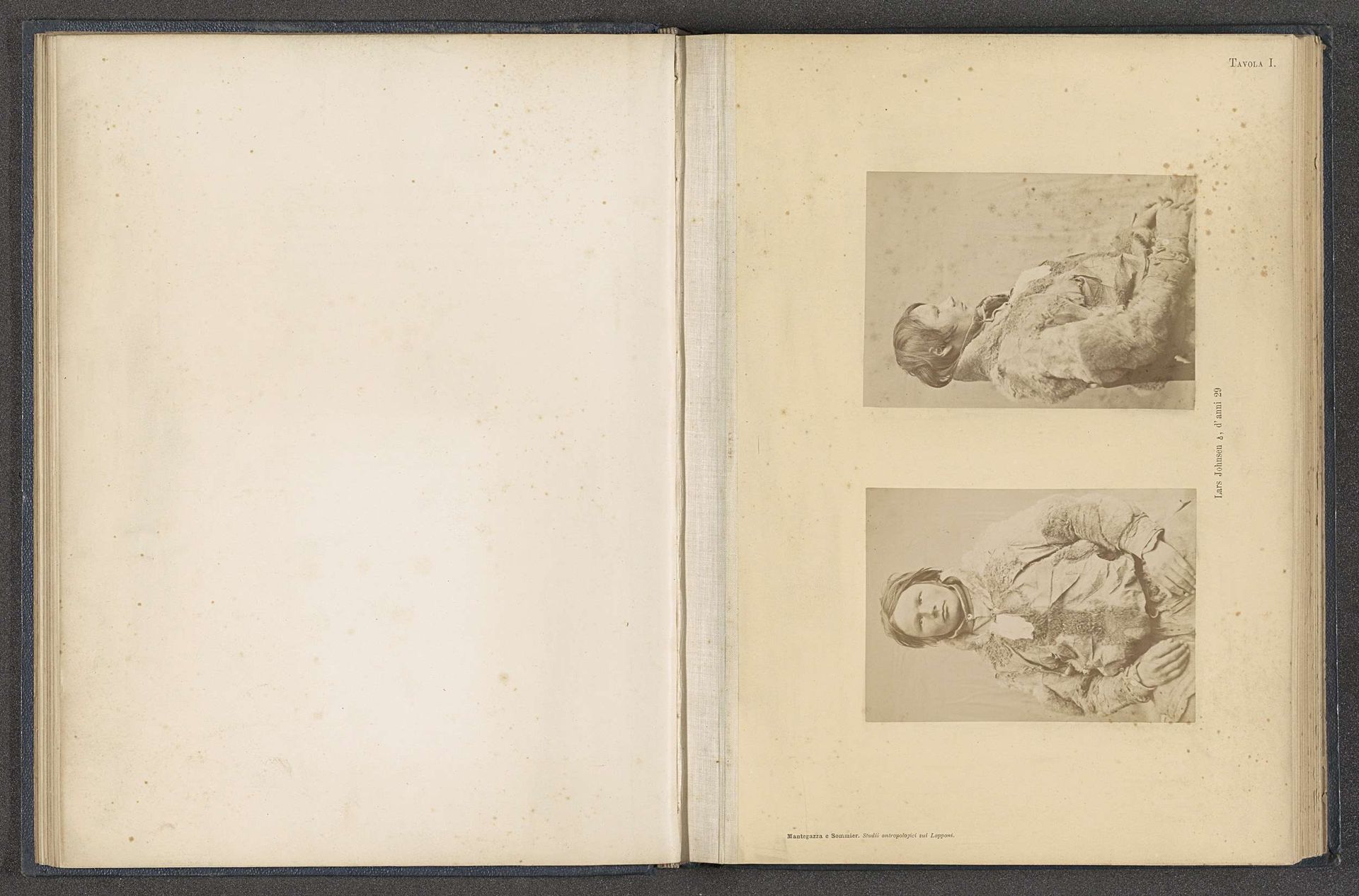 Twee portretten van Lars Johnsen by Paolo Mantegazza