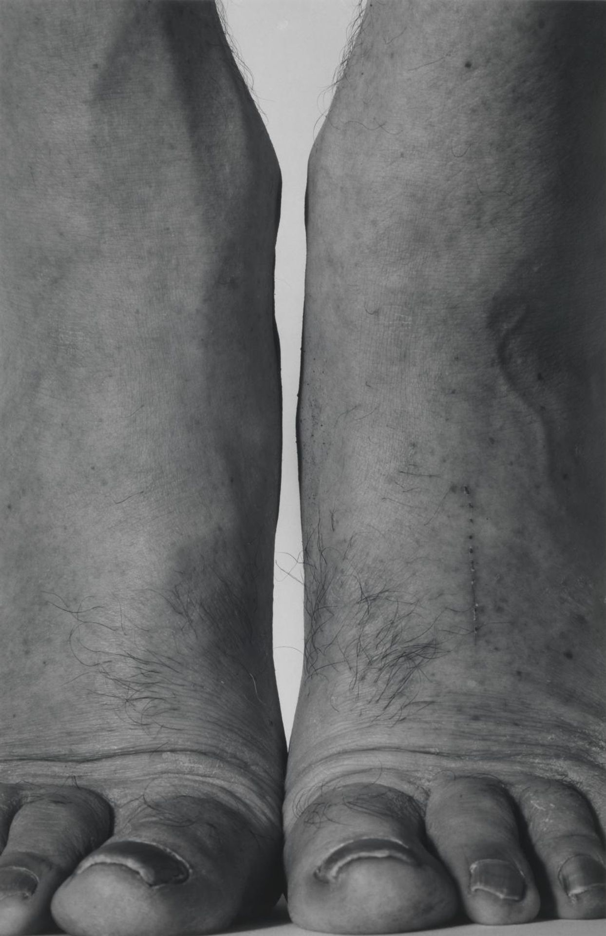 Self-Portrait (Feet Frontal) by  John Coplans