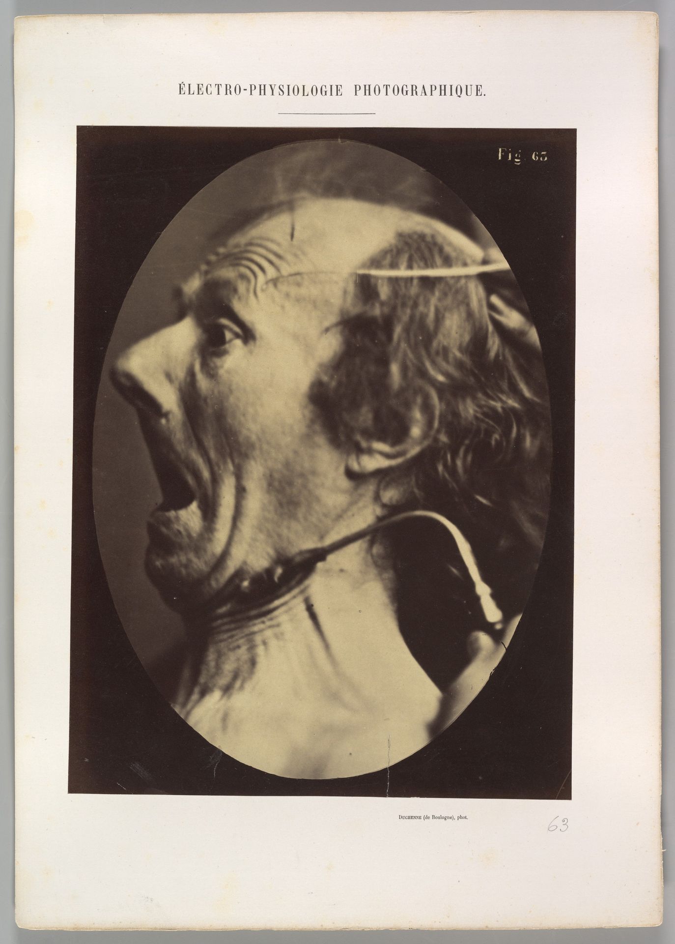 Figure 63: Expression of terror by Guillaume Benjamin Amand Duchenne