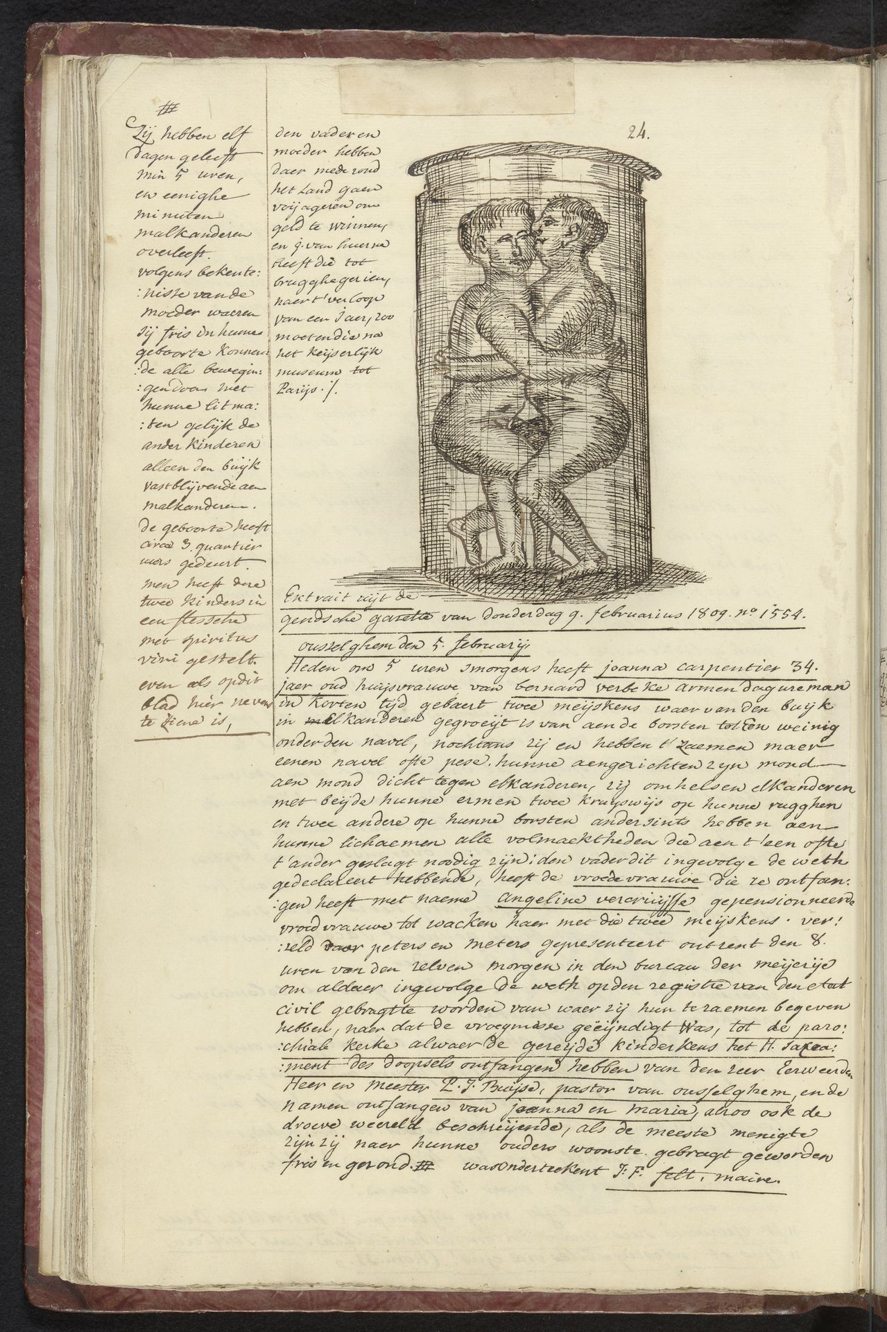 Siamese tweeling uit Gent, 1809 by Joseph van Huerne