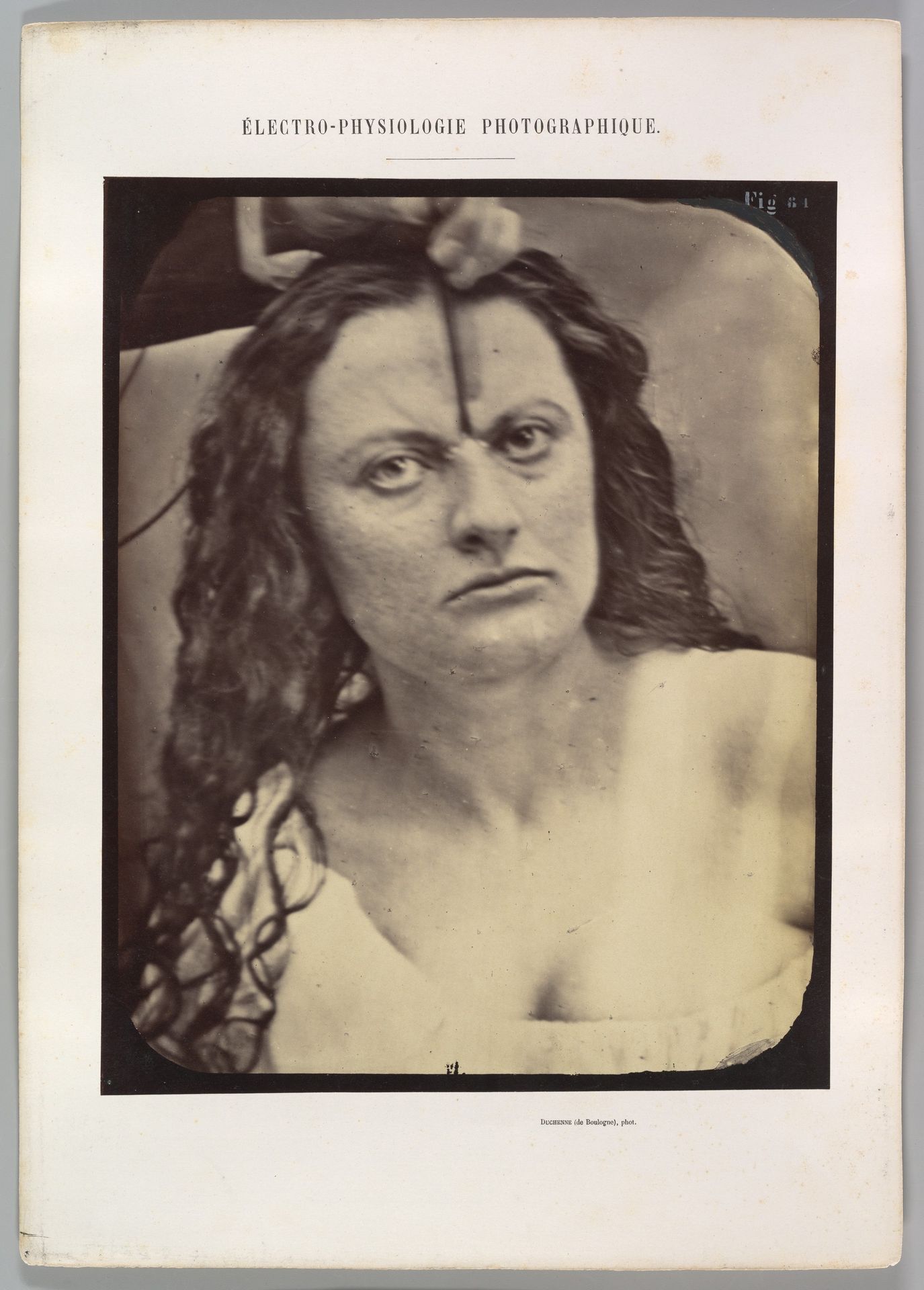 Figure 81: Lady Macbeth, moderate expression of cruelty by Guillaume Benjamin Amand Duchenne