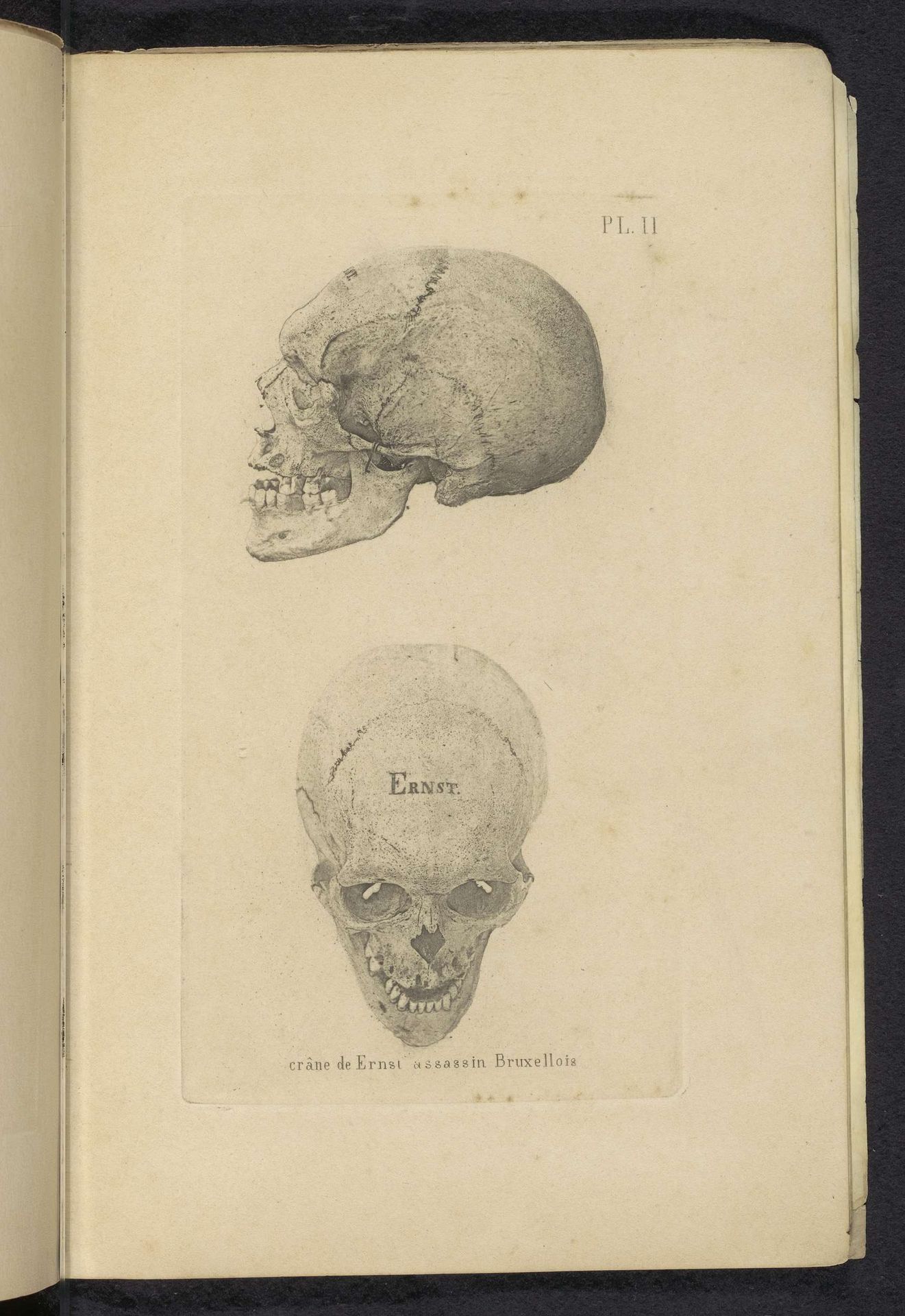 Twee aanzichten van een schedel by Anonymous