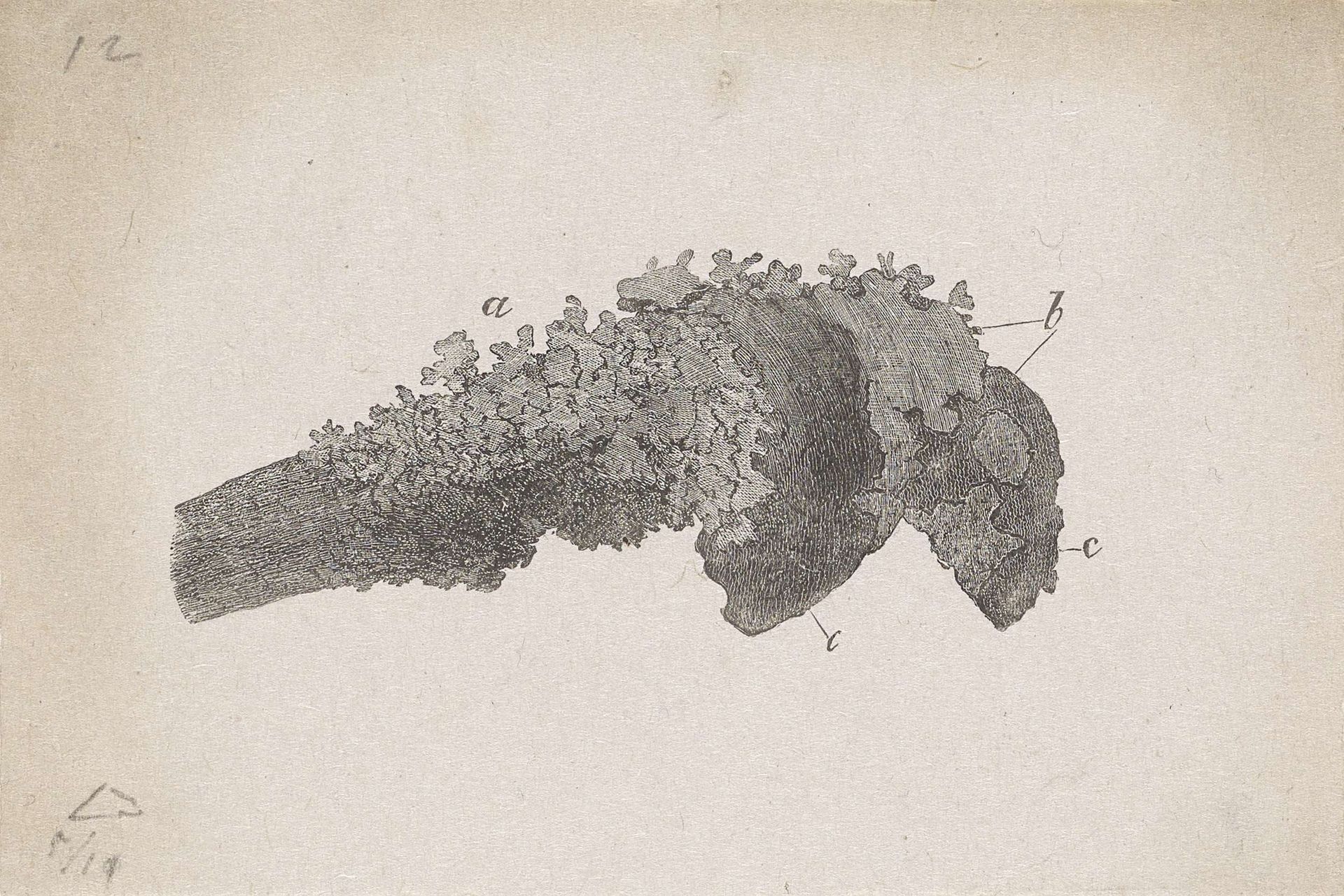 Menselijk bot met een afwijking by Isaac Weissenbruch
