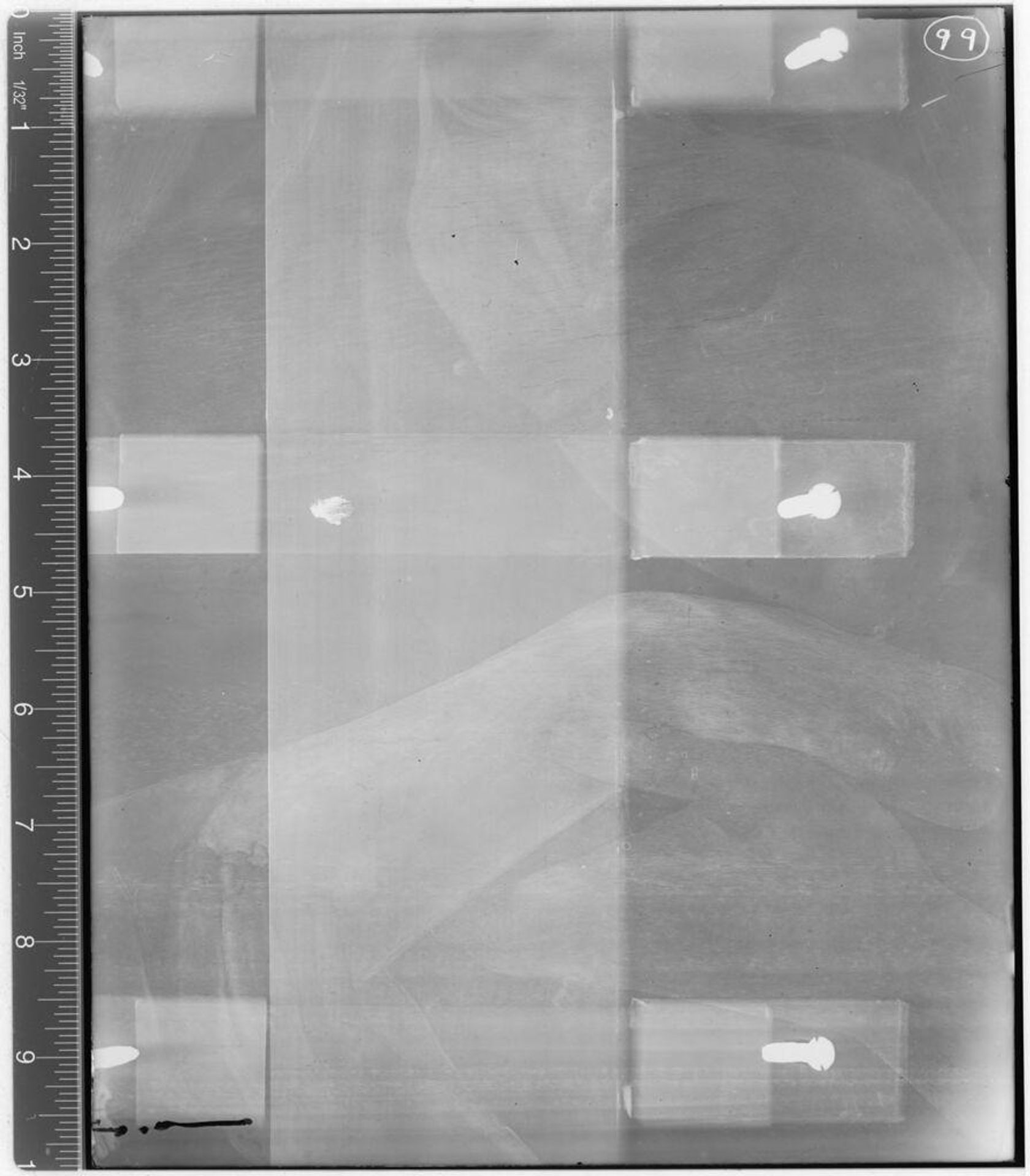 X-radiograph(s) of "Pieta" by Artist of original: Marco Basaiti