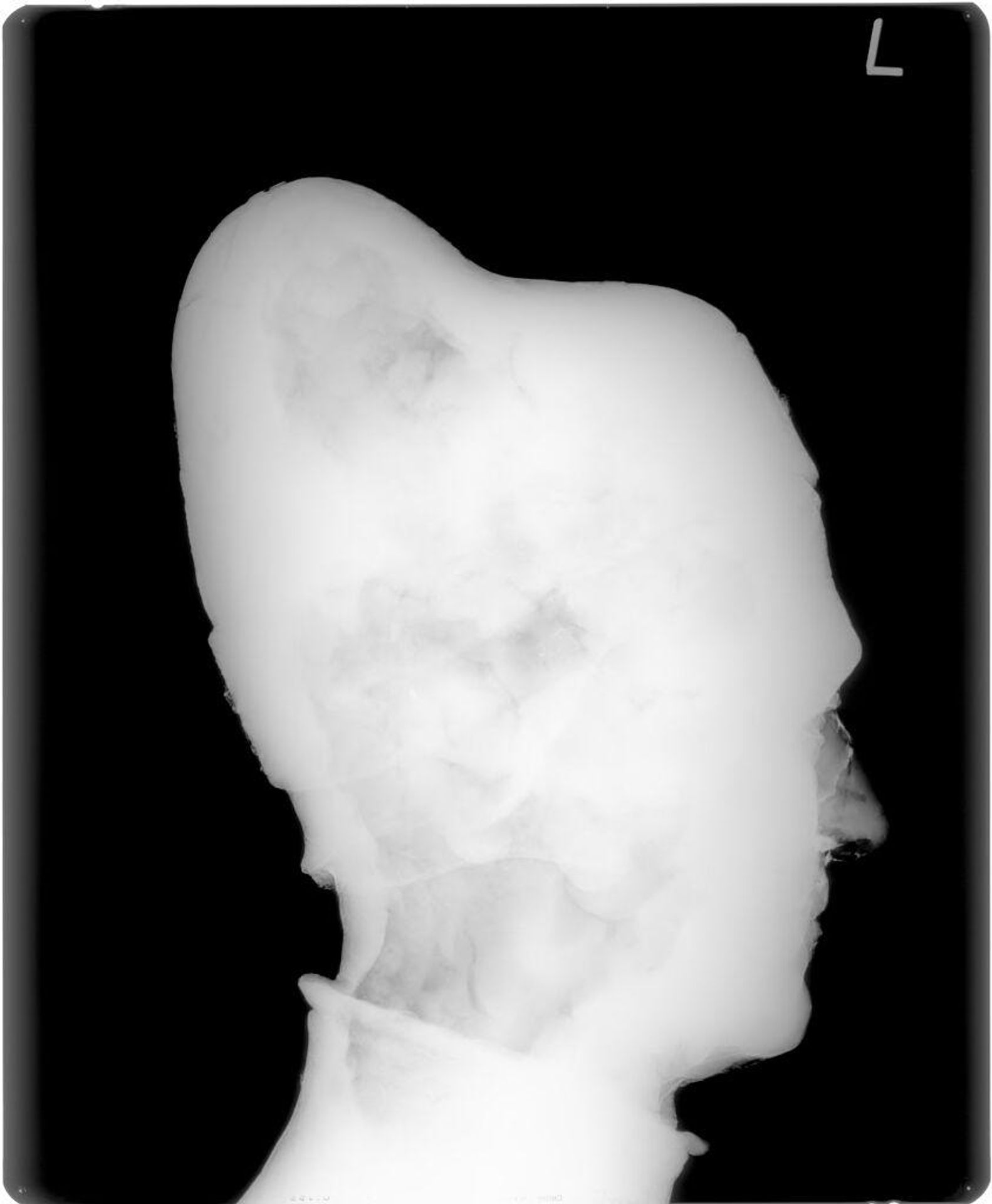 X-radiograph(s) of "Doge Leonardo Loizedan" by Artist of original: Danese Cattaneo