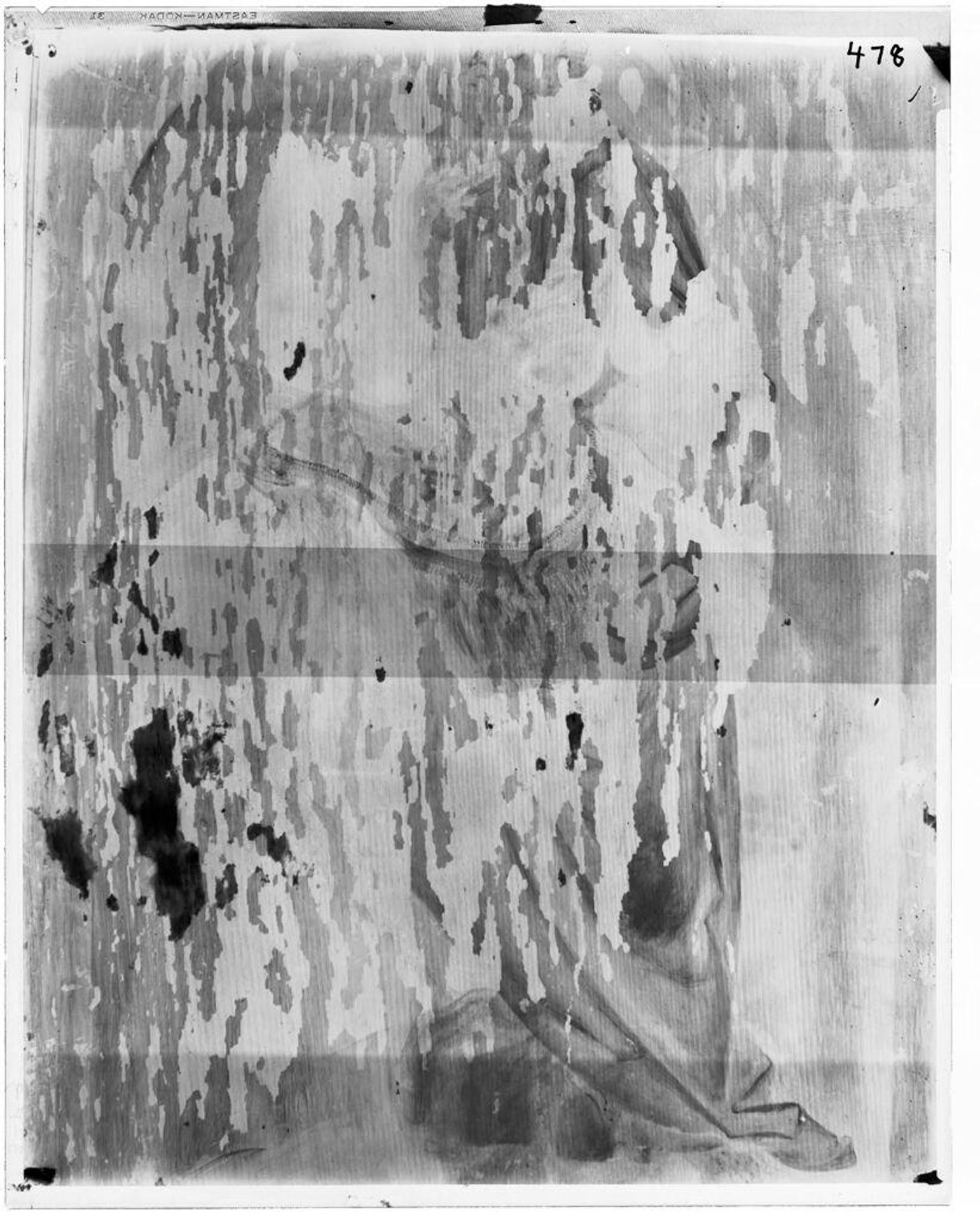 X-radiograph(s) of "Portrait of a Man" by Artist of original: Lucas Cranach the Elder
