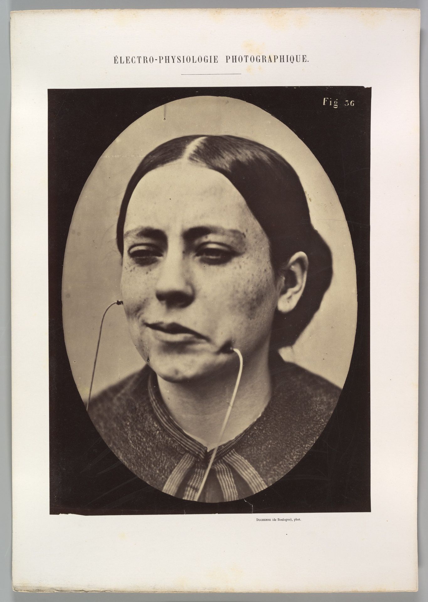 Figure 36: Scornful laughter and scornful disgust by Guillaume Benjamin Amand Duchenne