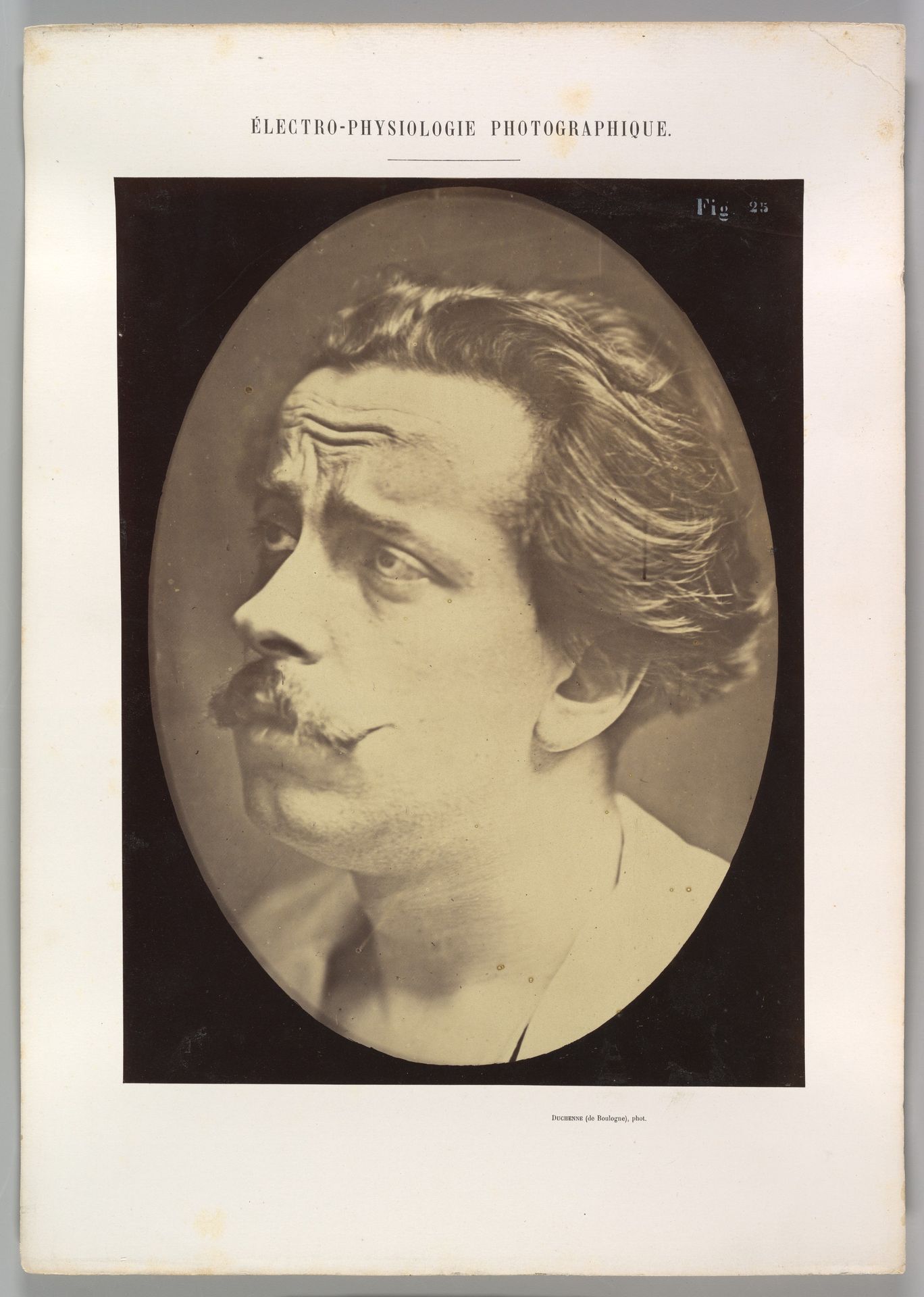 Figure 25: Not an expression of pain by Guillaume Benjamin Amand Duchenne