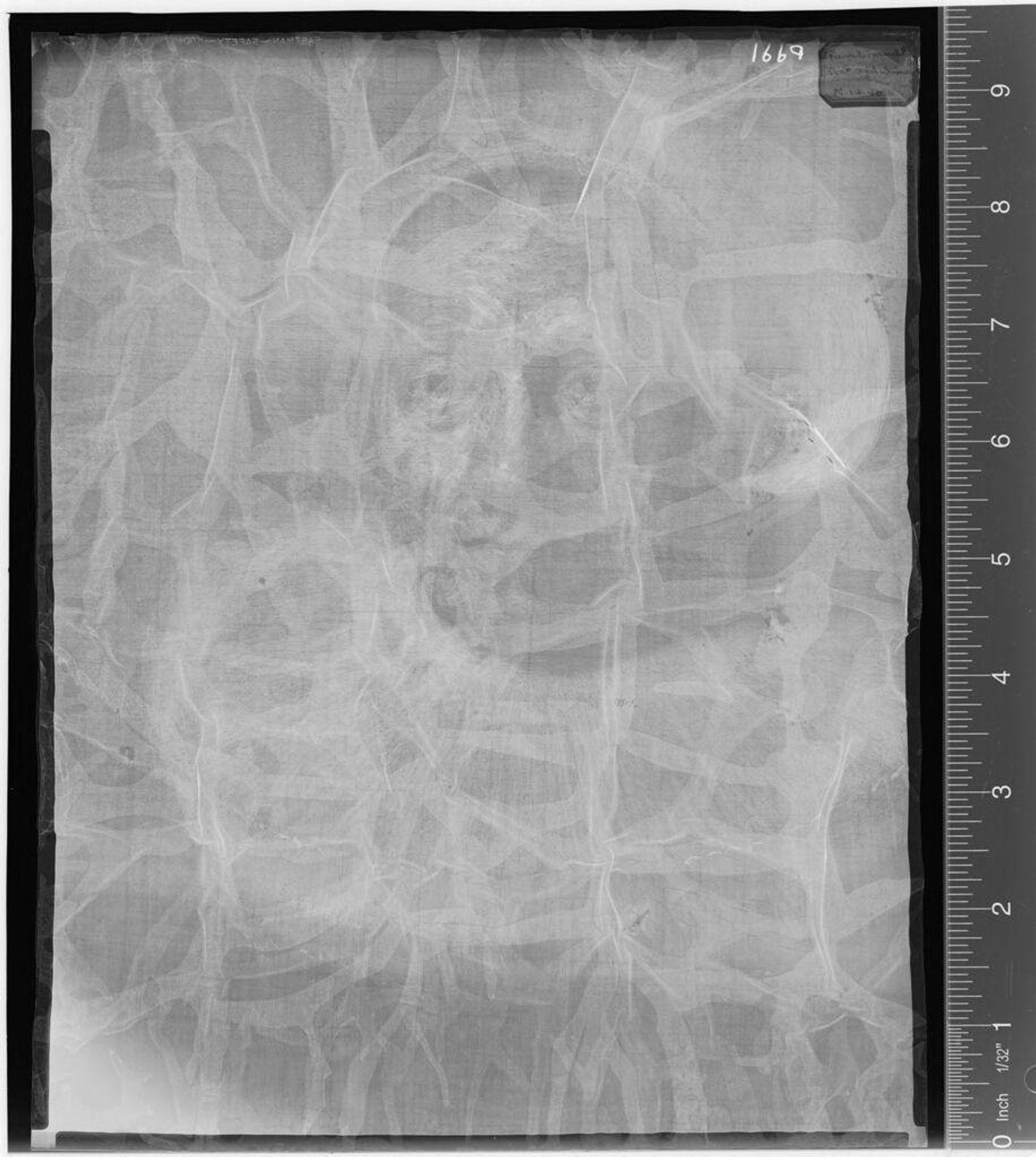 X-radiograph(s) of "Old Woman in a Armchair" by Artist of original: Rembrandt Harmensz. van Rijn