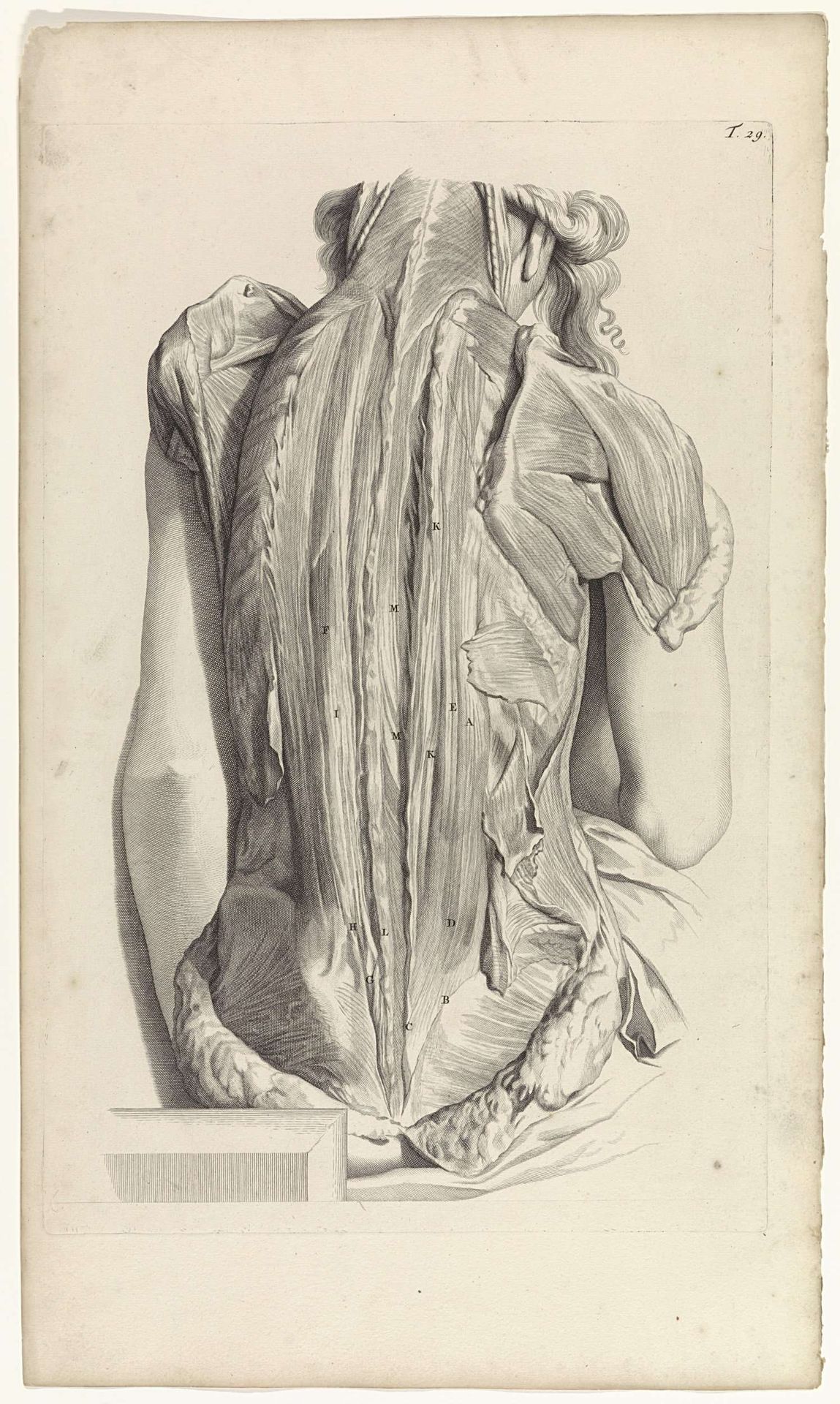 Tweede anatomische studie van de spieren van de rug en de bovenarmen van een vrouw by Pieter van Gunst