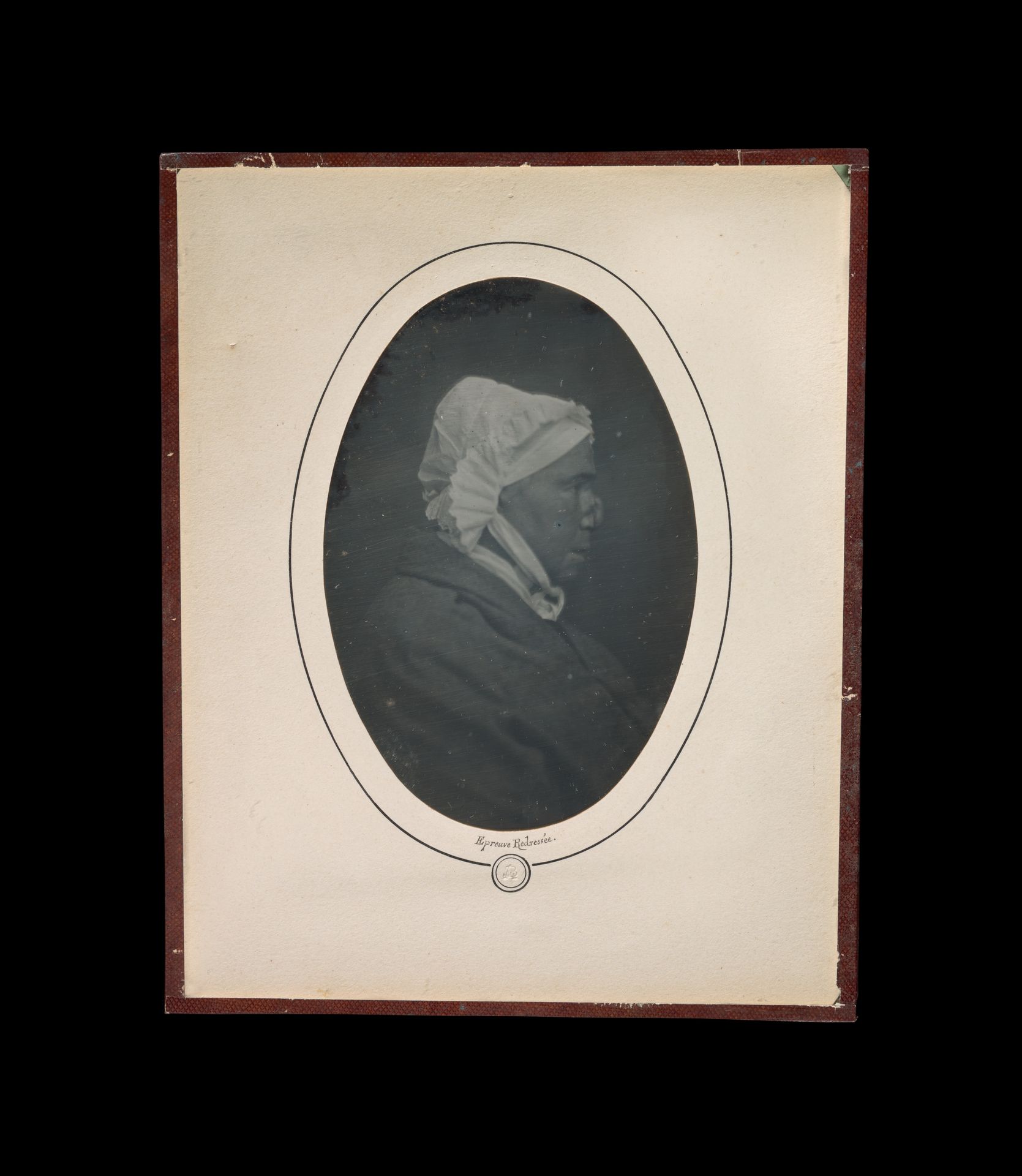 [Profile of a Woman with Necrosis of the Nose] by Louis-Auguste Bisson