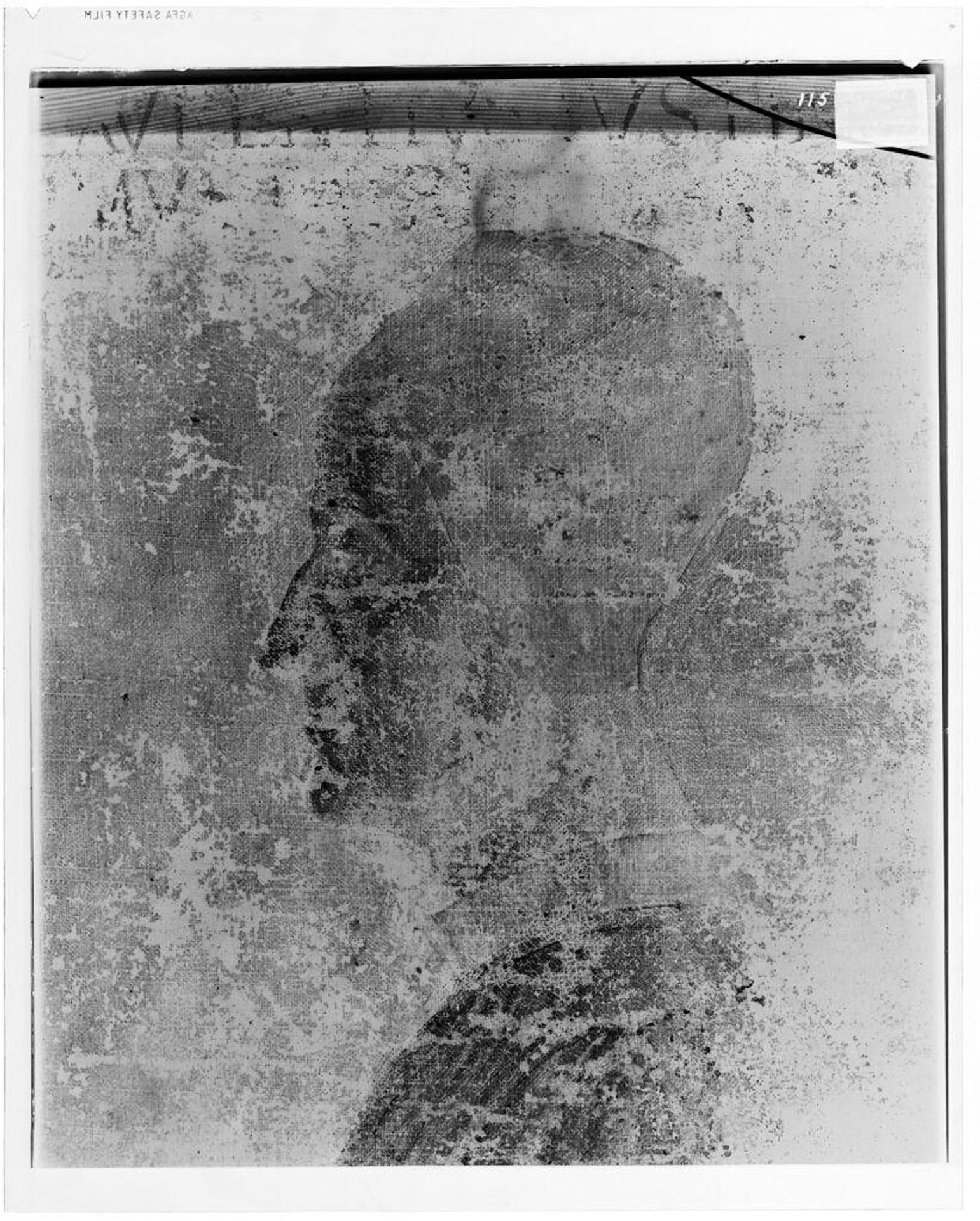 X-radiograph(s) of "Lorenzo Giustiniani" by Artist of original: School of Gentile Bellini