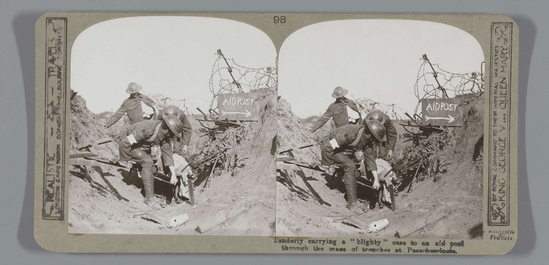 Tenderly carrying a "blighty" case to an aid post through the maze of trenches at Passchendaele by Realistic Travels
