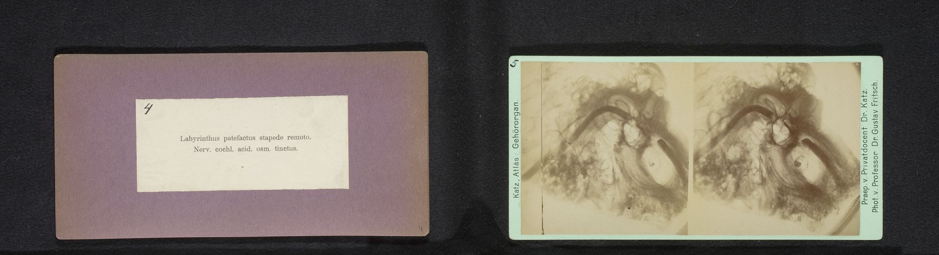 Microscoopopname van het gehoororgaan van een mens met het labyrint zichtbaar by Gustav Fritsch