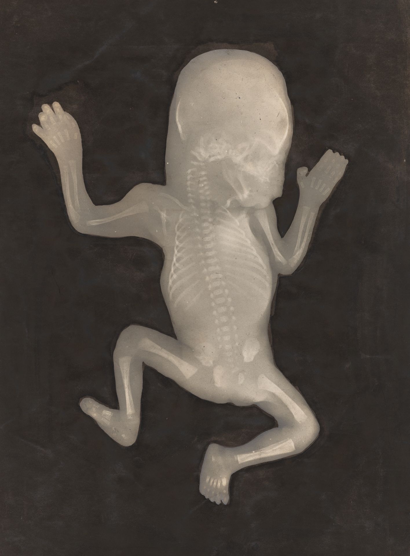 Degree of Ossification of a Five-Month-Old Fetus (Degré d'ossification d'un Foetus de cinq mois) by Anonymous