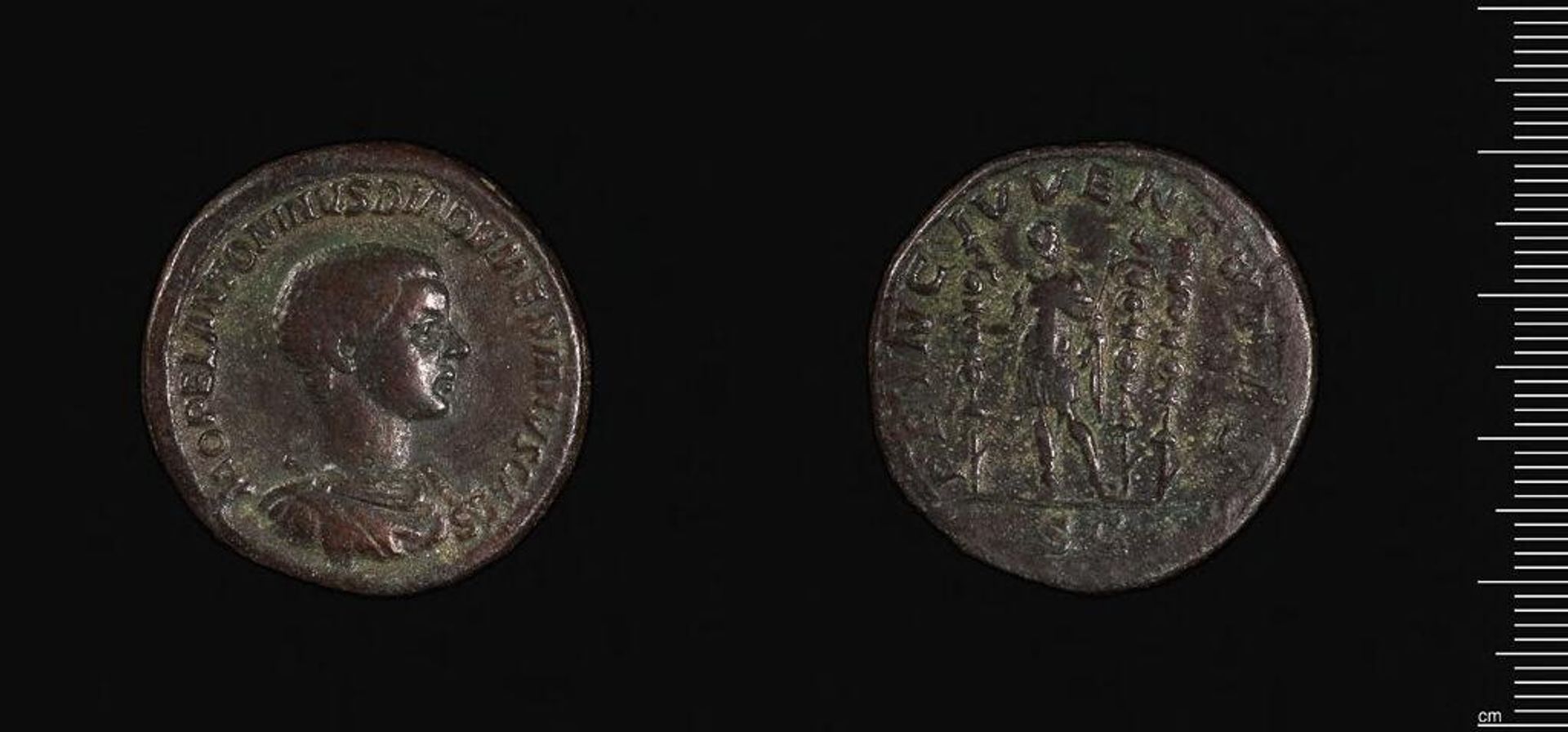 Sestertius of Diadumenianus (cast?) by Diadumenian