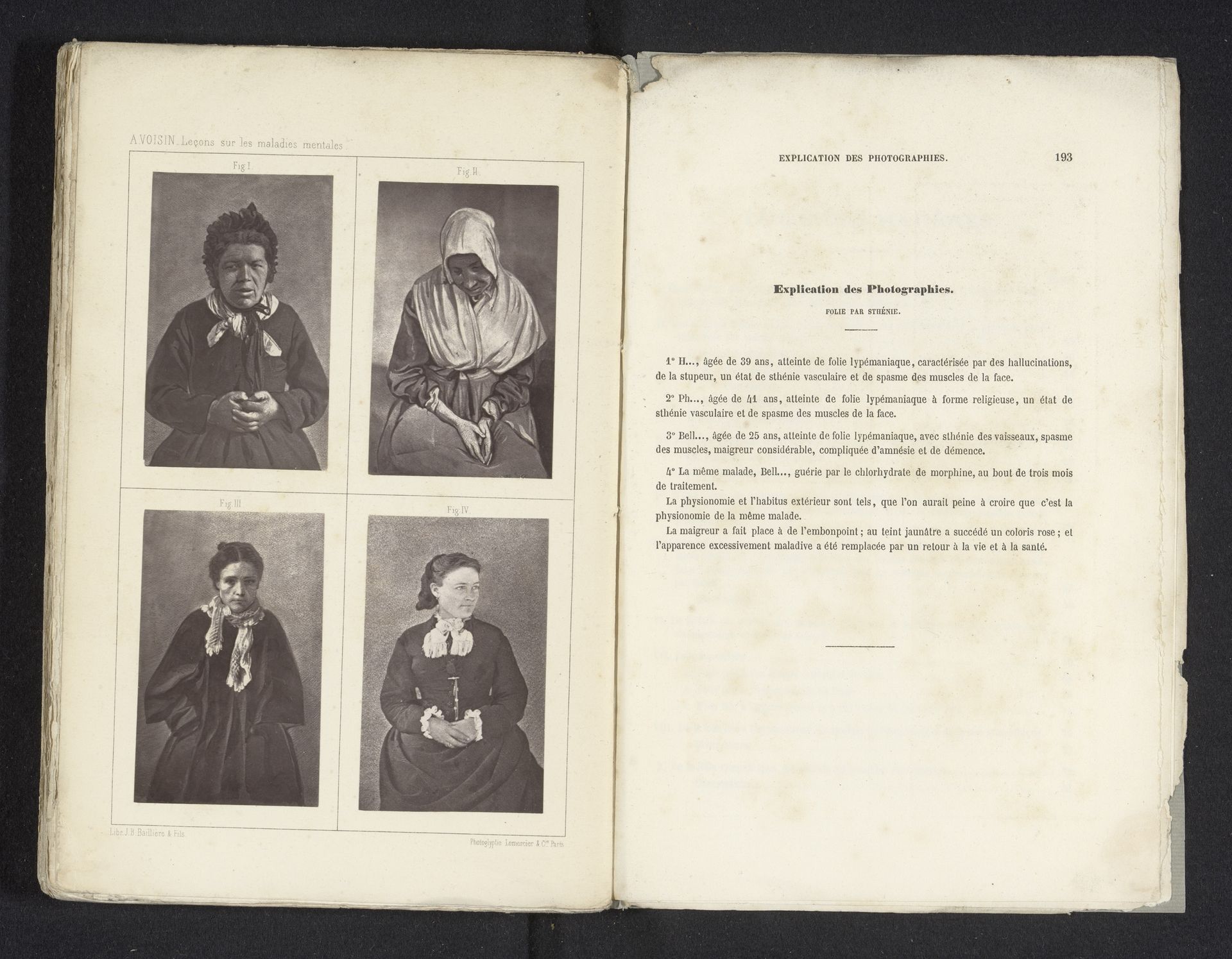 Vier portretten van vrouwen met een psychische aandoening by Anonymous