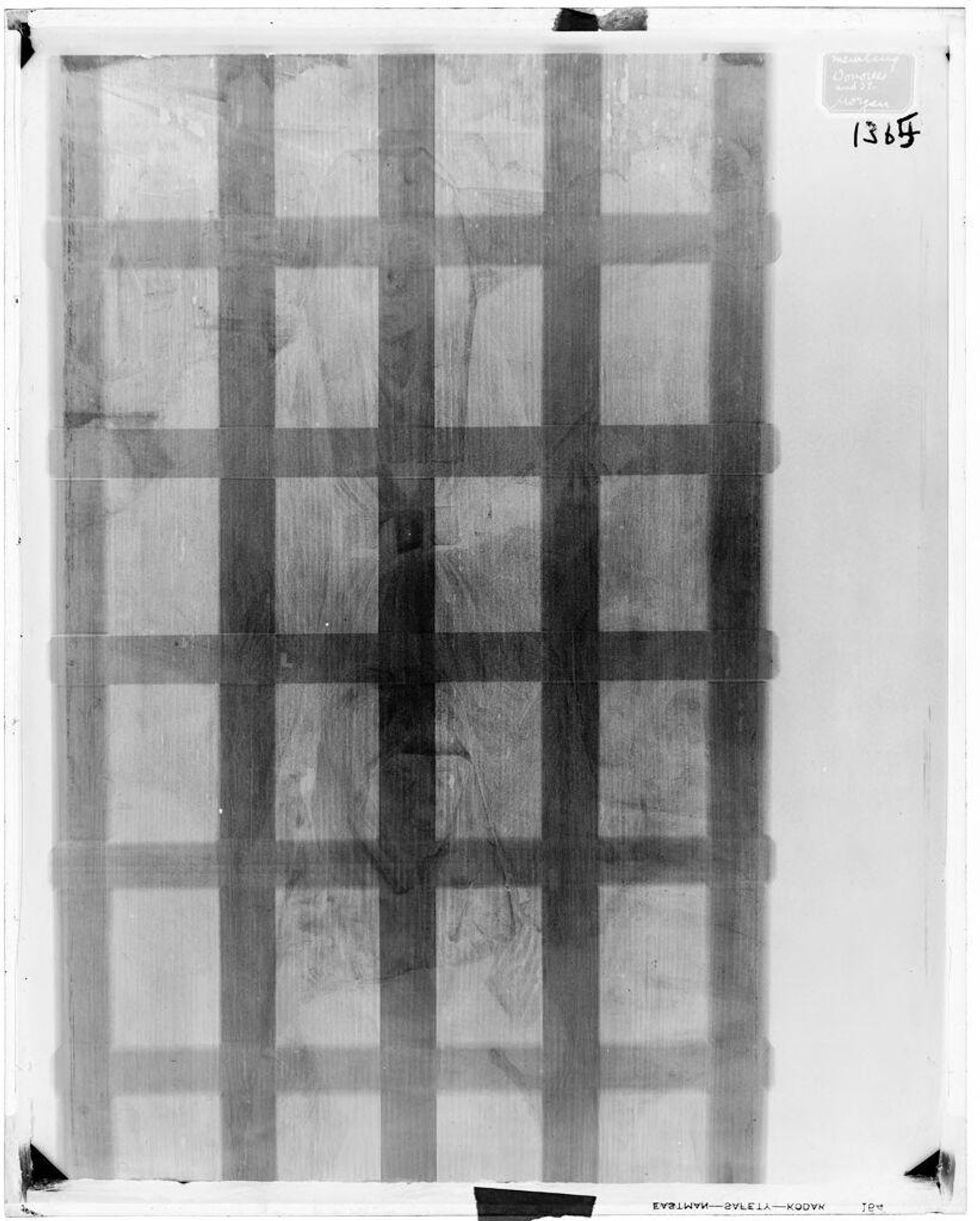 X-radiograph(s) of "Donor" by Artist of original: Hans Memling