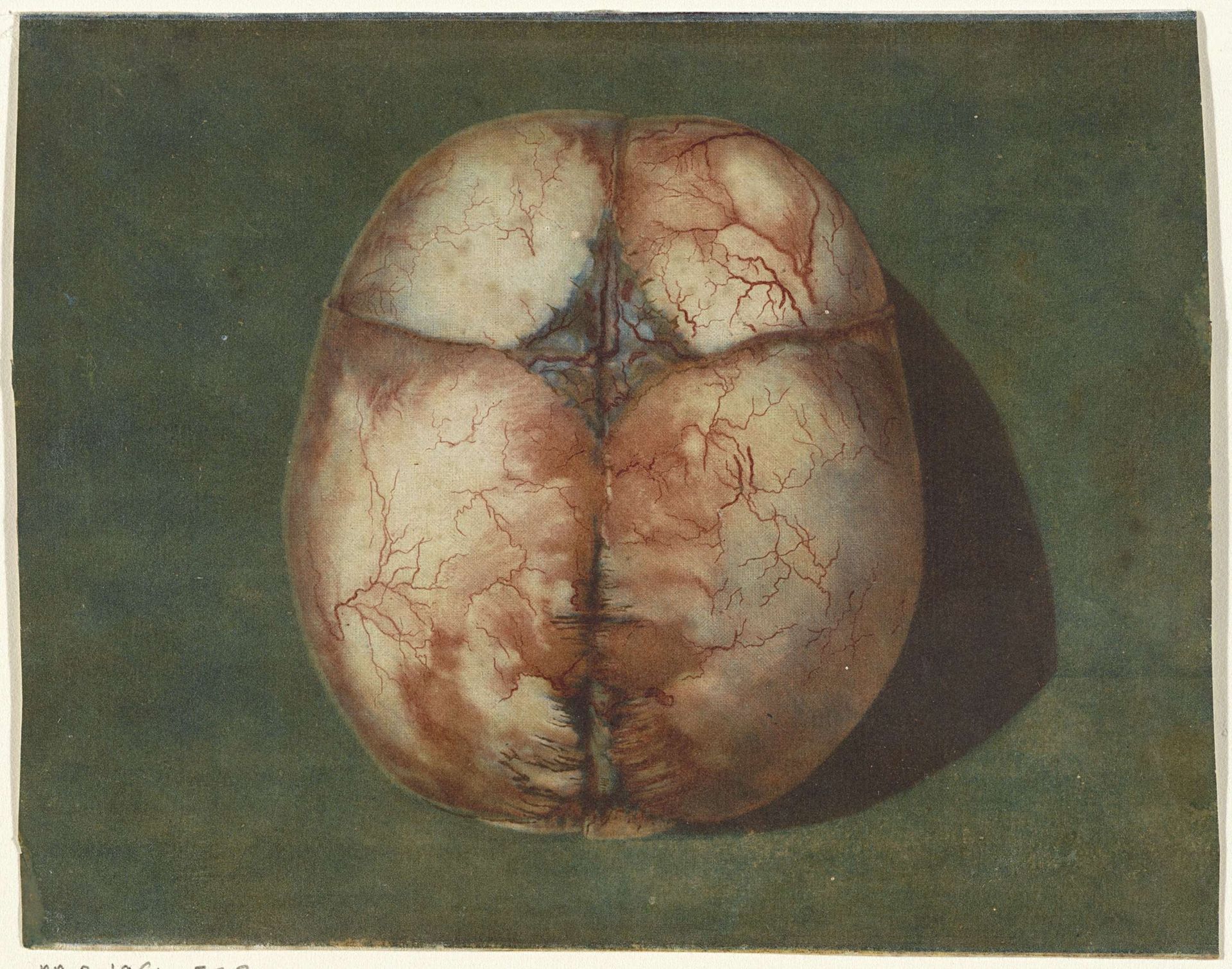 Anatomische studie van de schedel van een onvoldragen kindje by Jan l' Admiral